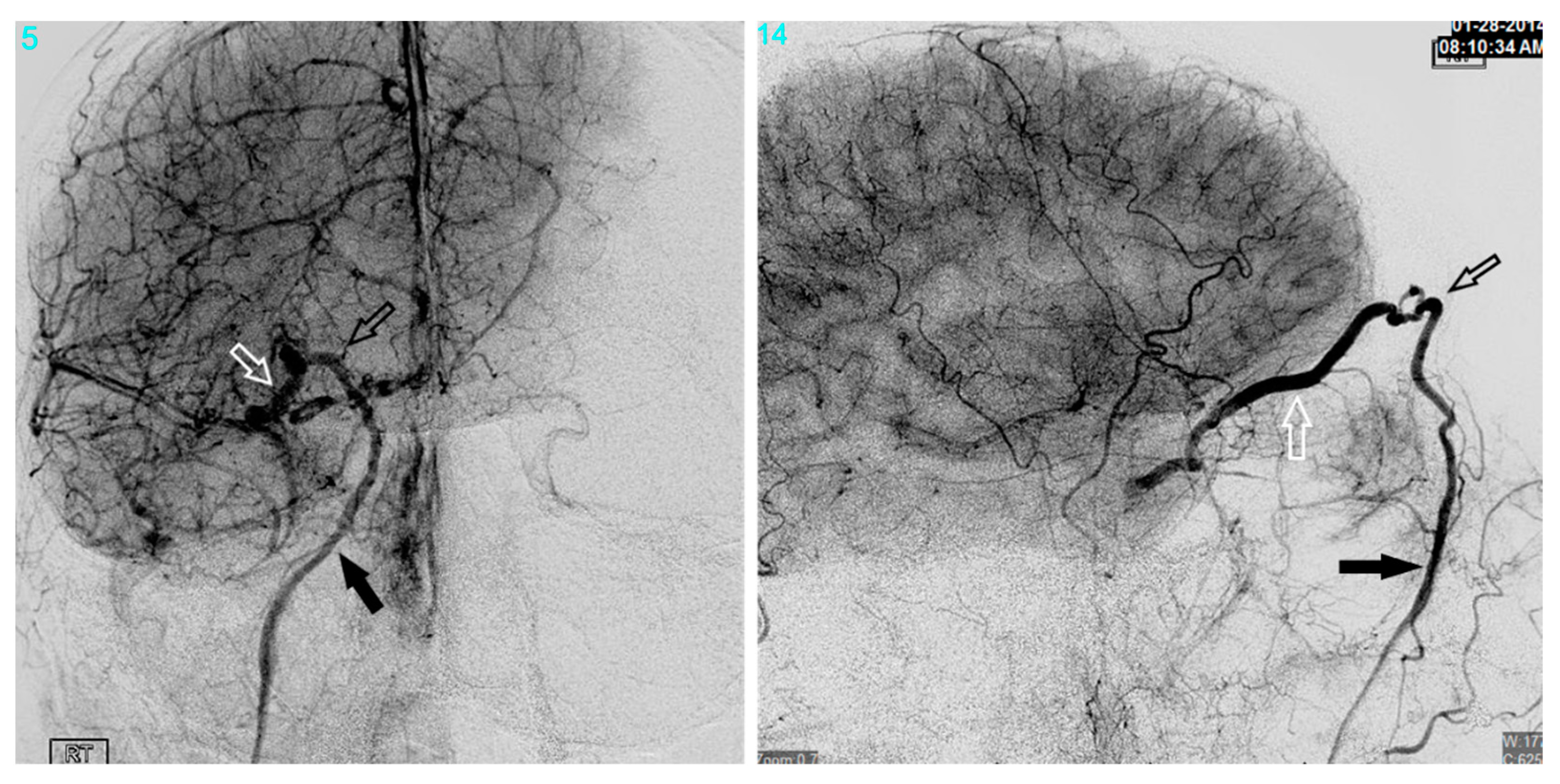 Brainsci 10 00554 g002
