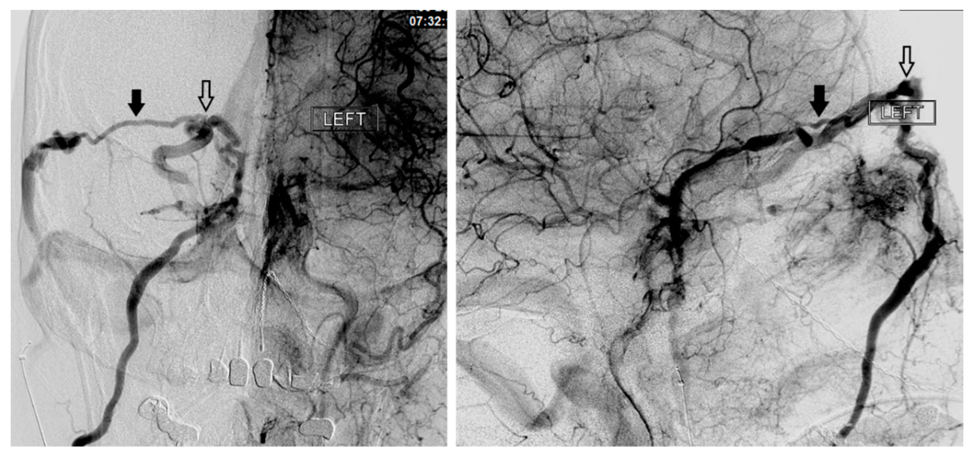 Brainsci 10 00554 g003