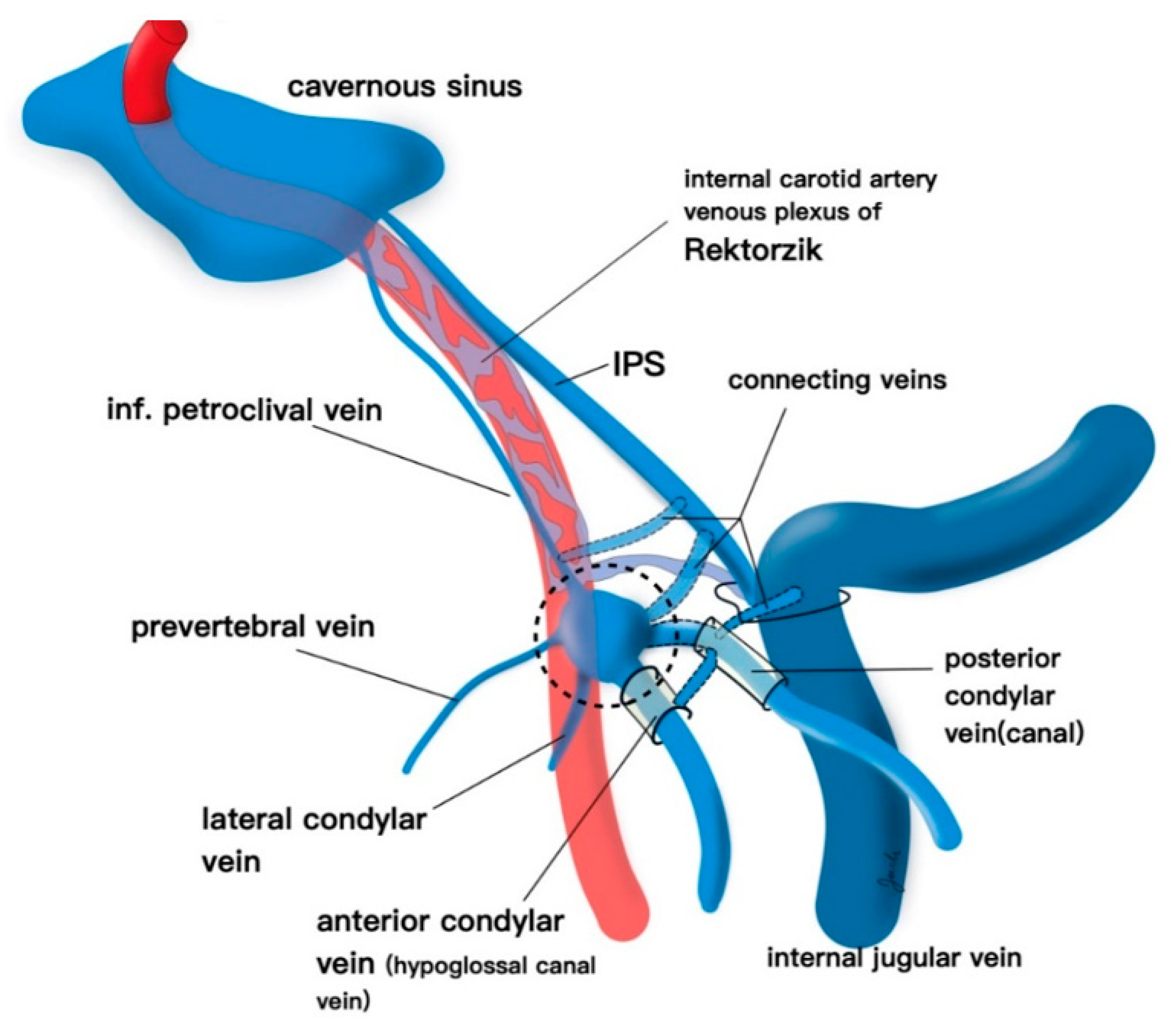 Endovascular Approaches to the Cavernous Sinus in the