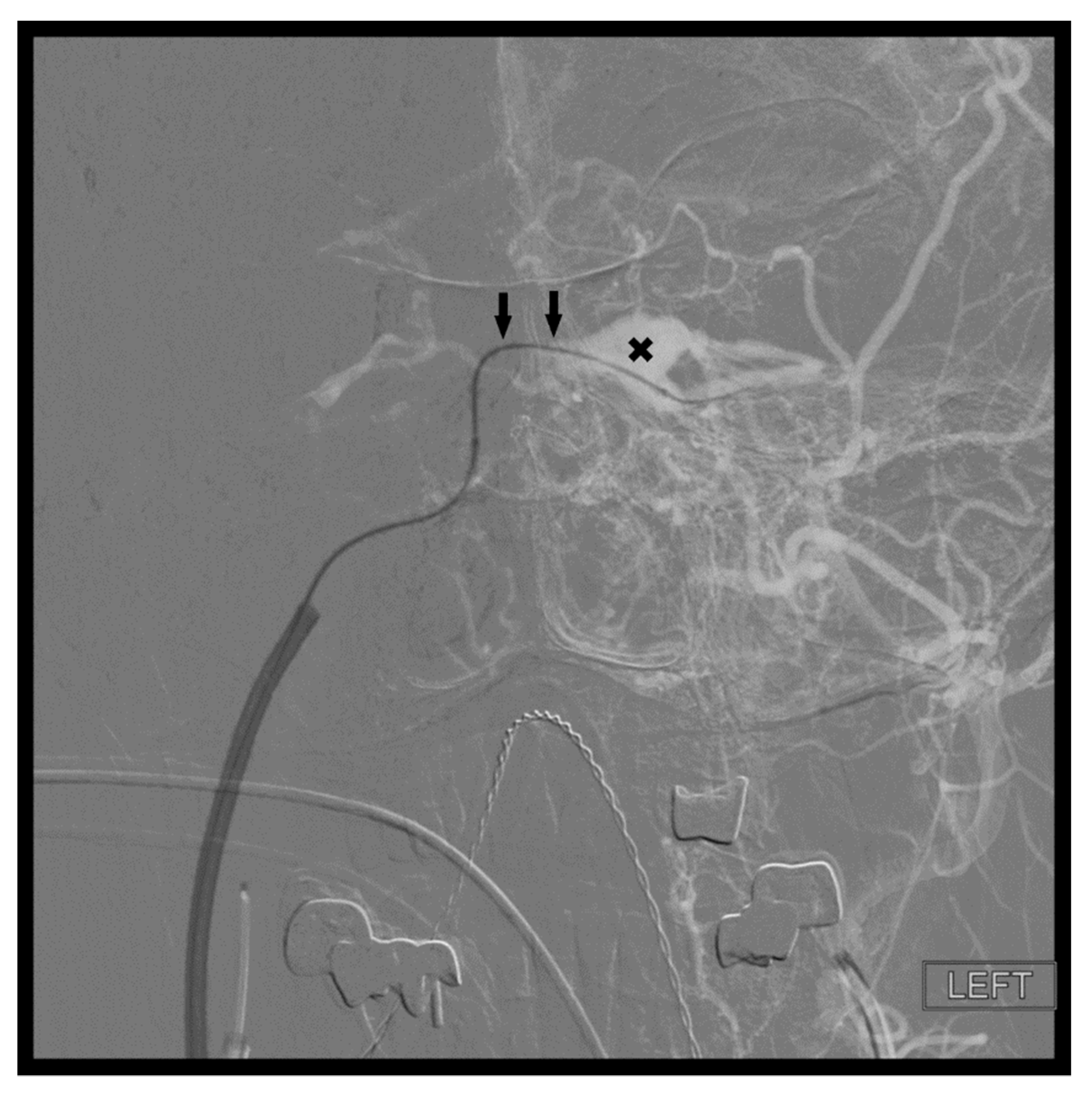 Brainsci 10 00554 g006