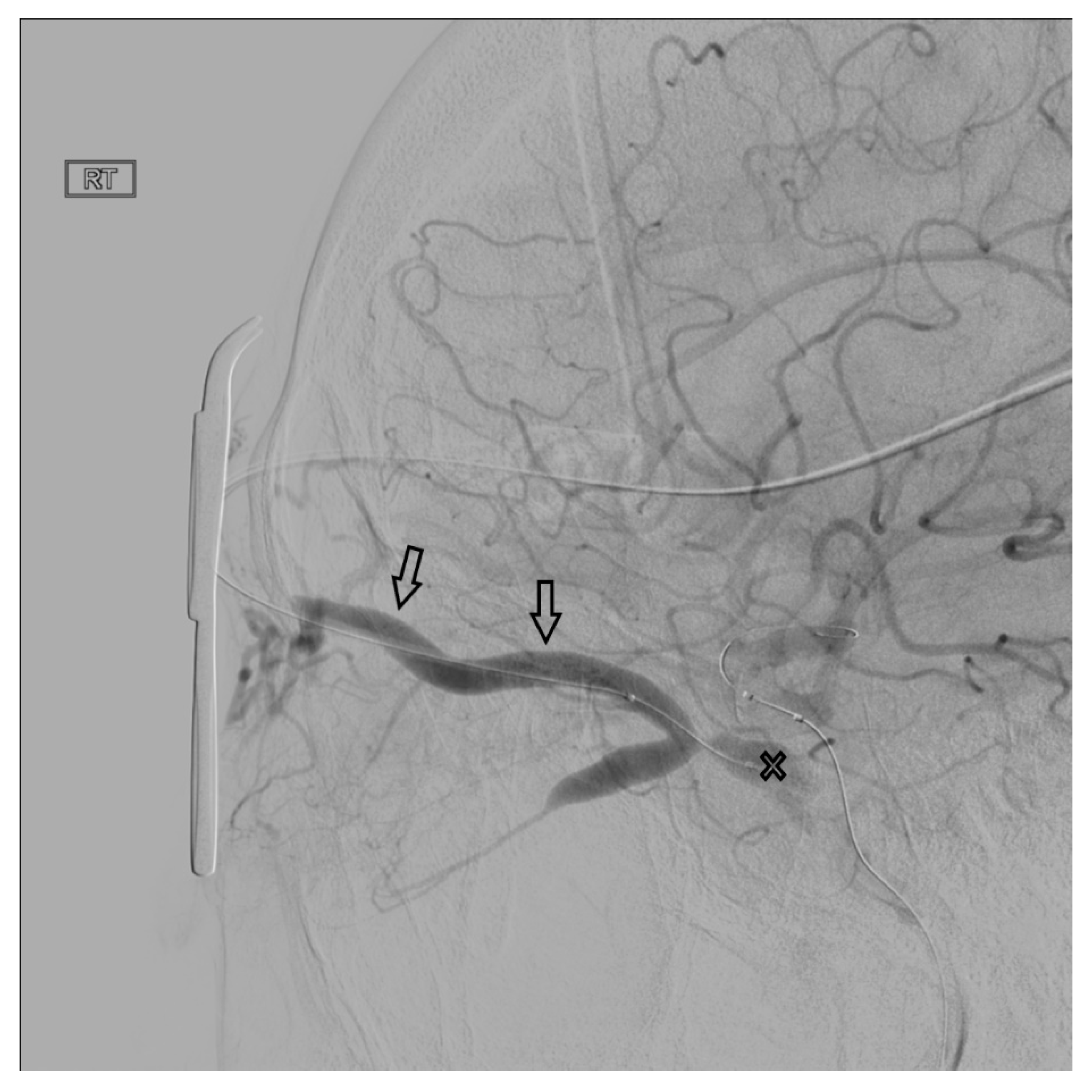 Brainsci 10 00554 g008
