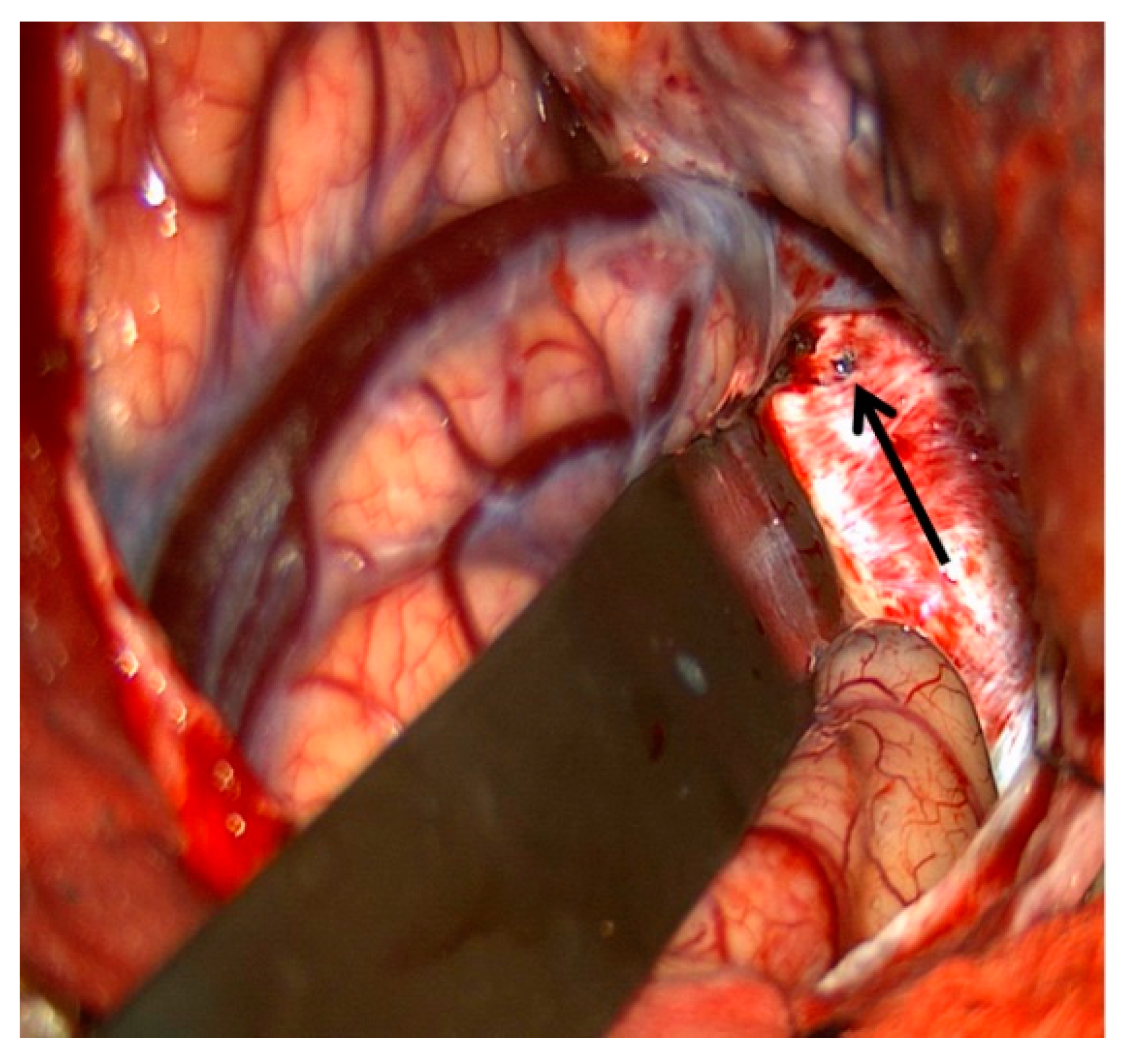 Brainsci 10 00554 g009