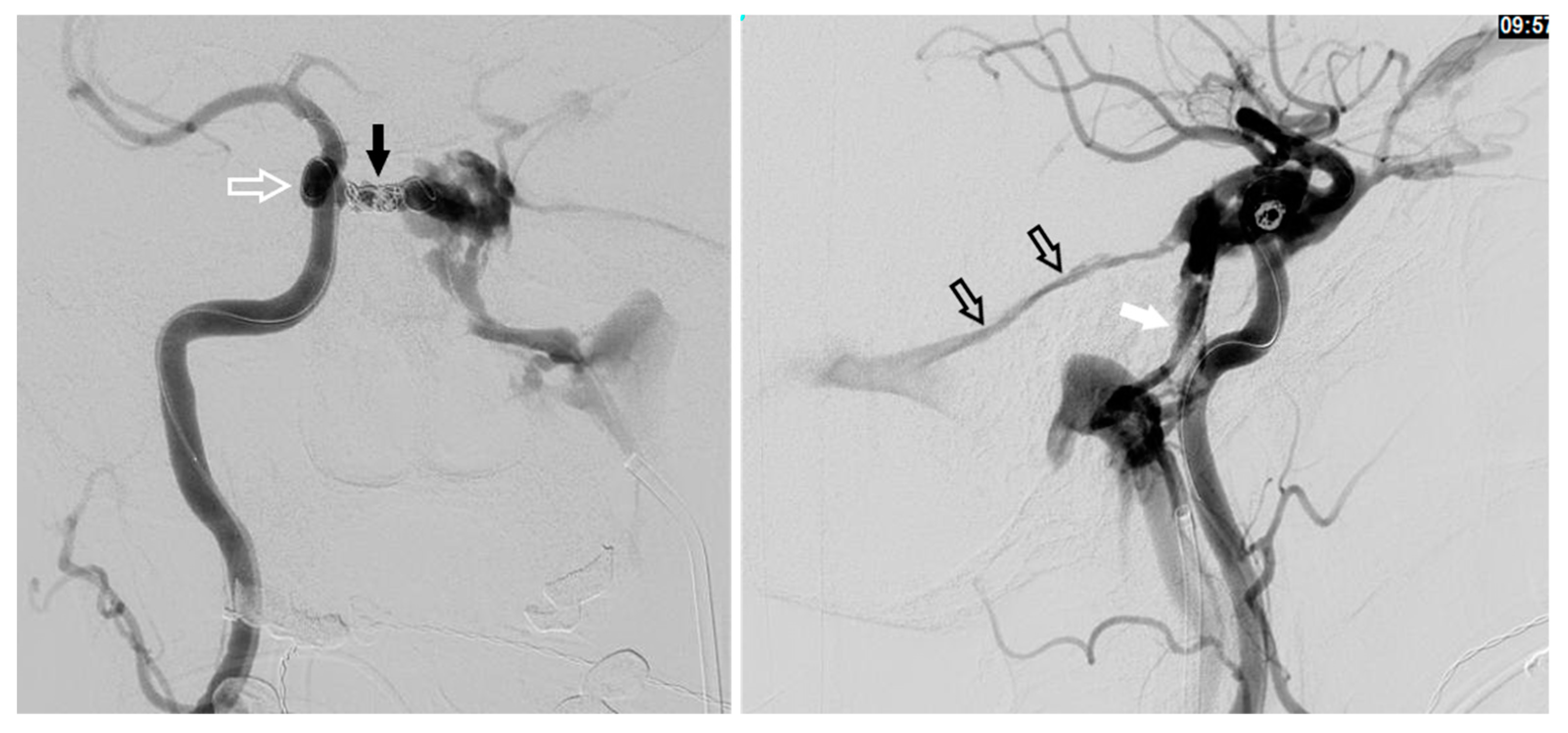 Brainsci 10 00554 g010