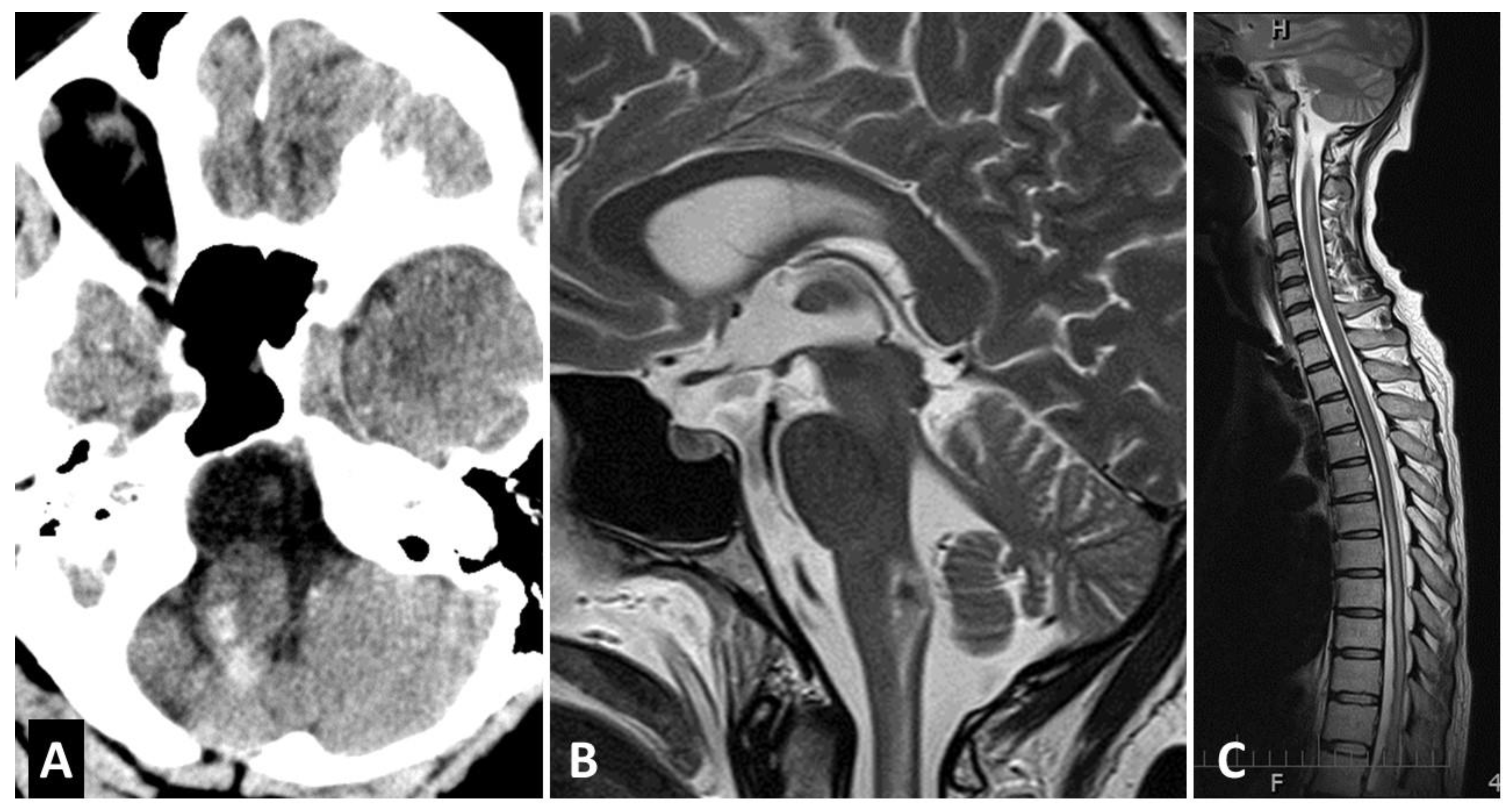 Brainsci 10 00561 g003 Brainsci 10 00561 g003