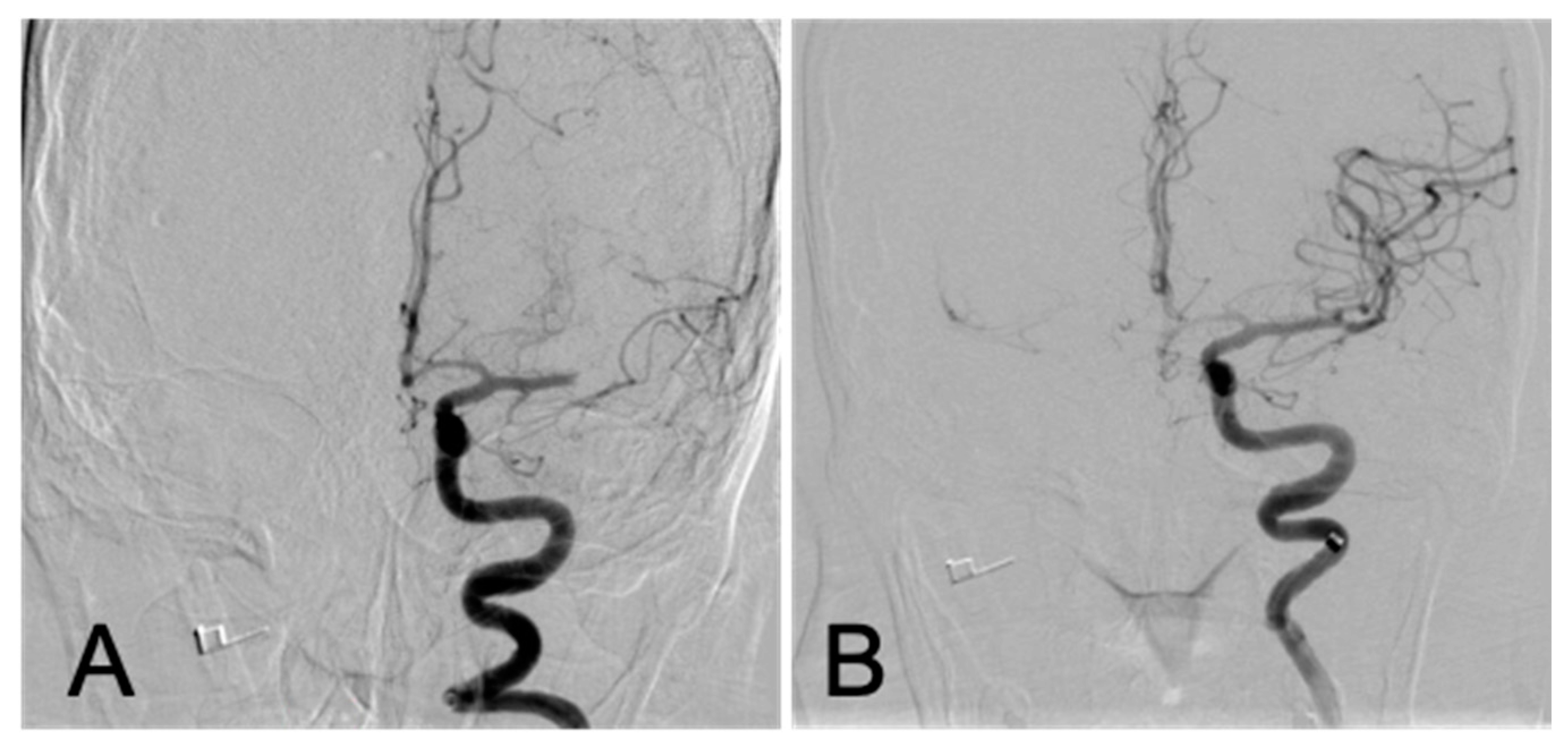 Brainsci 10 00590 g001