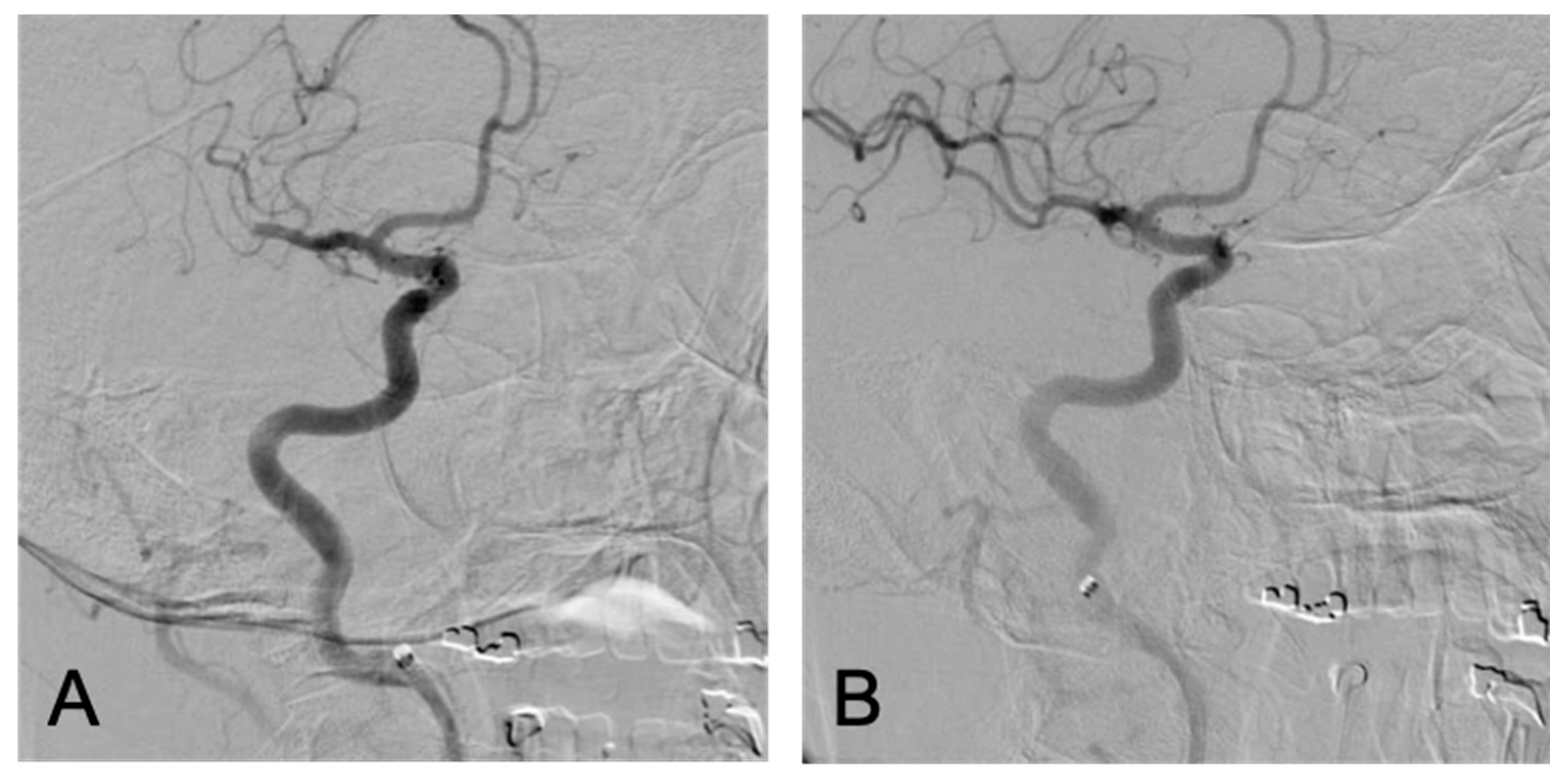 Brainsci 10 00590 g004