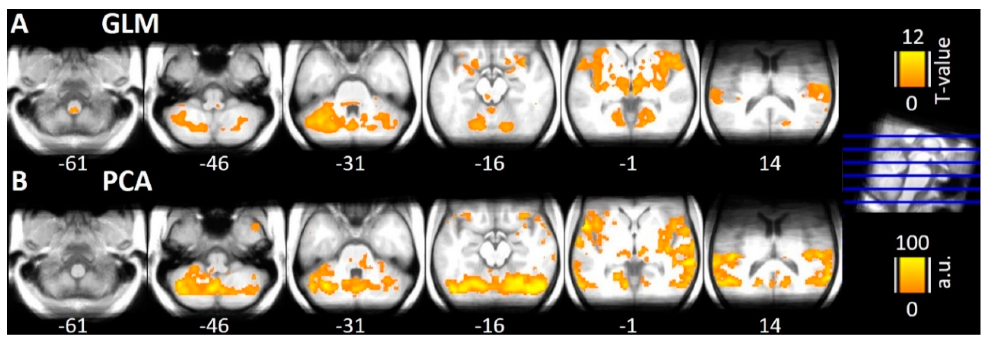 Brainsci 10 00603 g002 Brainsci 10 00603 g002