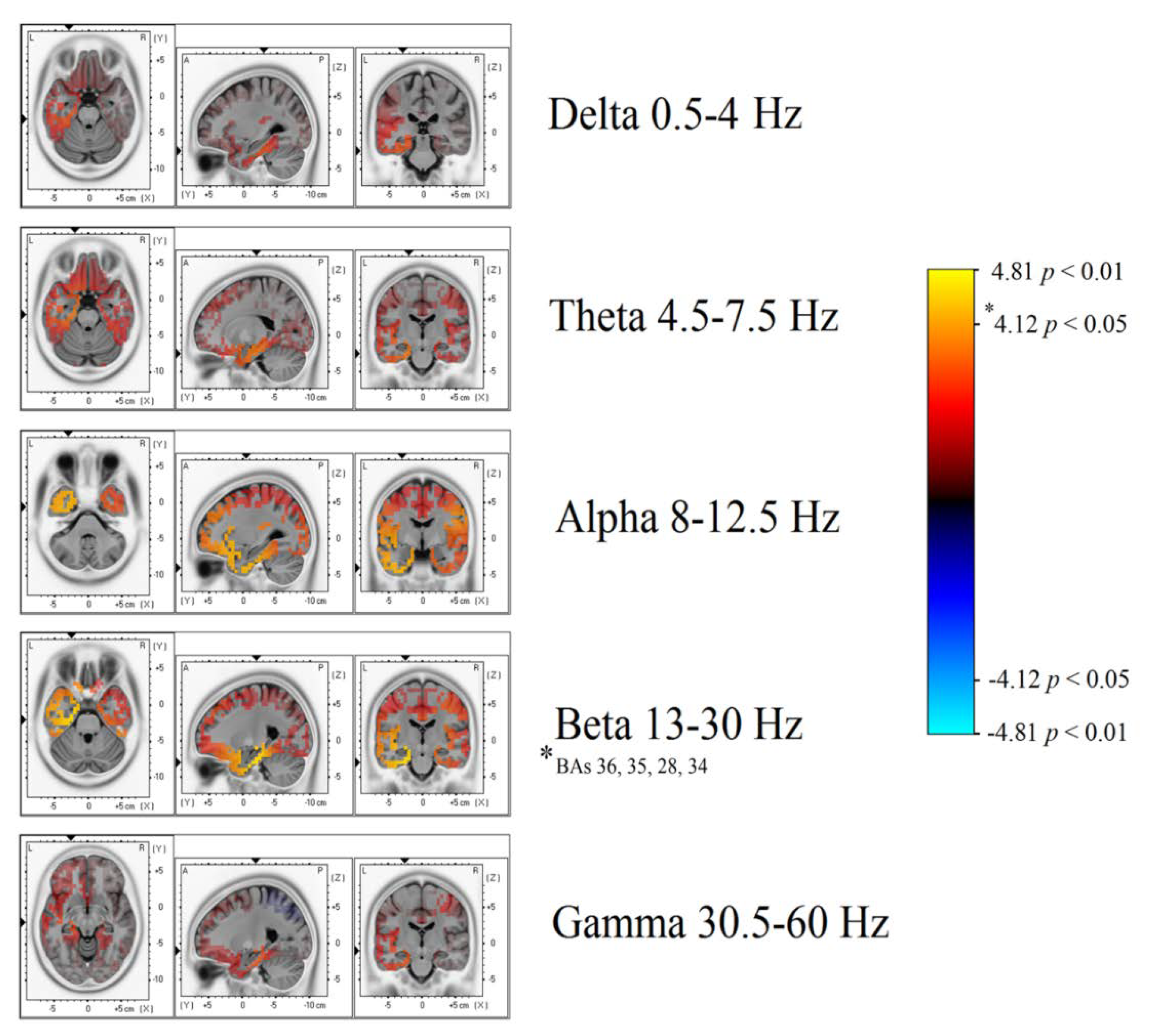Brainsci 10 00613 g003