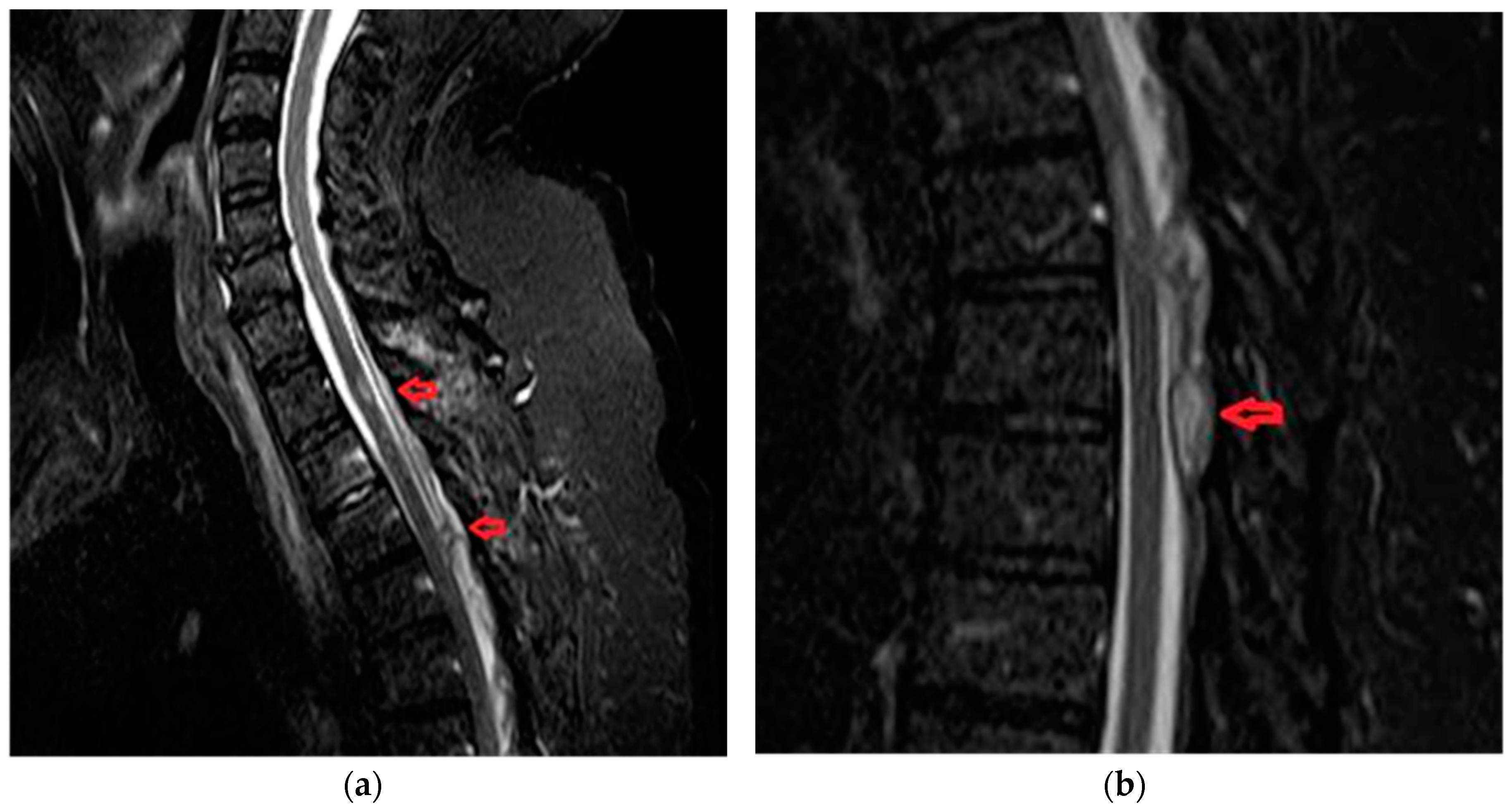 Brainsci 10 00618 g004