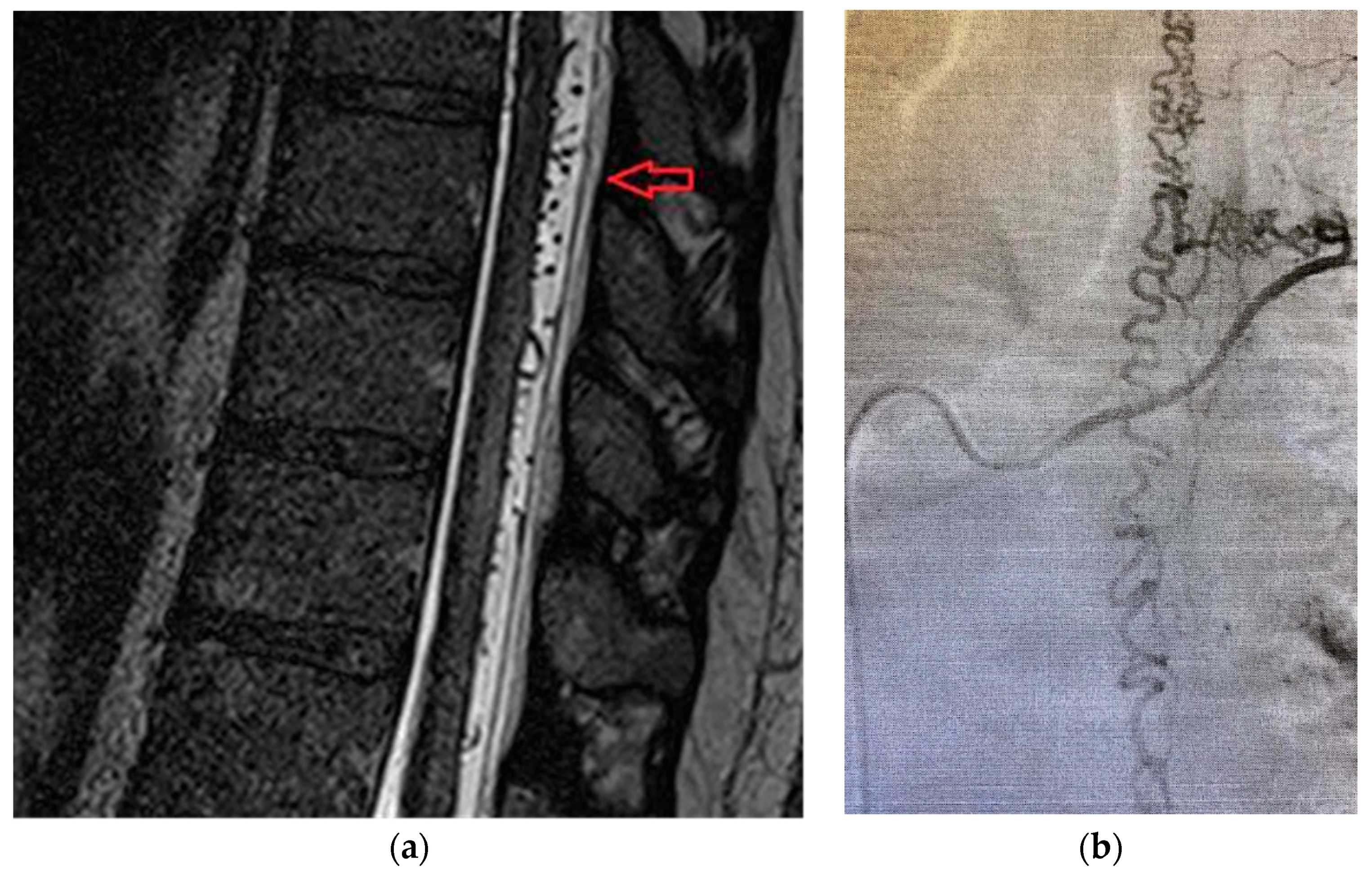 Brainsci 10 00618 g005