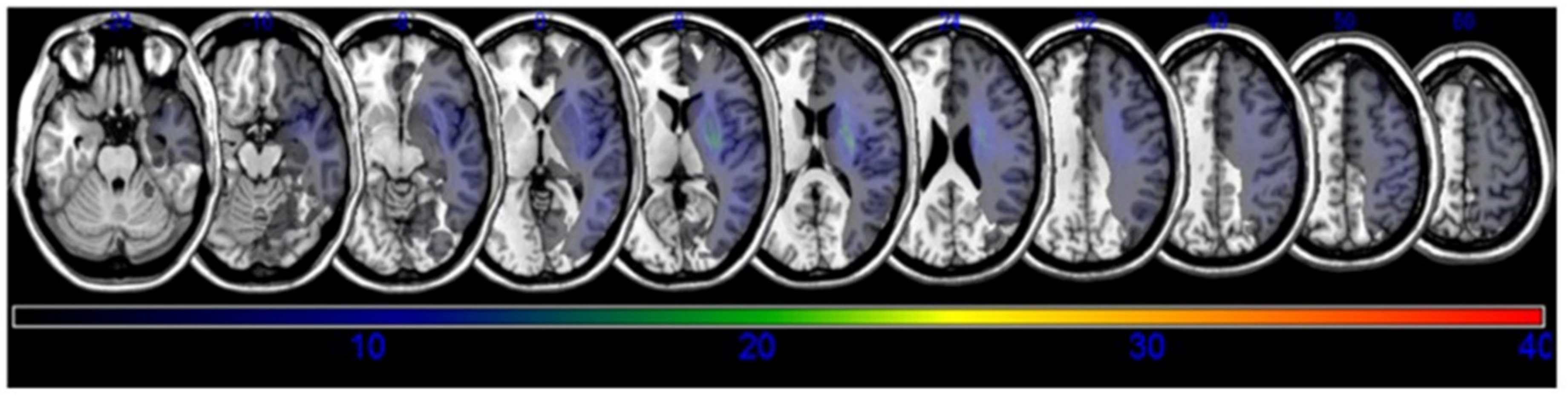 Brainsci 10 00627 g001 Brainsci 10 00627 g001