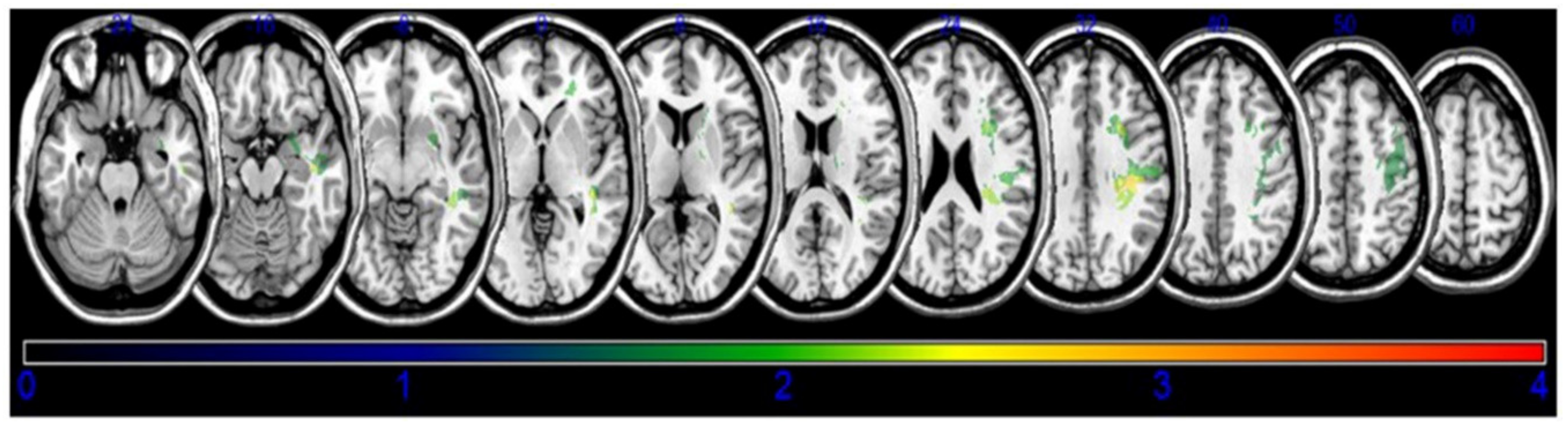 Brainsci 10 00627 g002 Brainsci 10 00627 g002