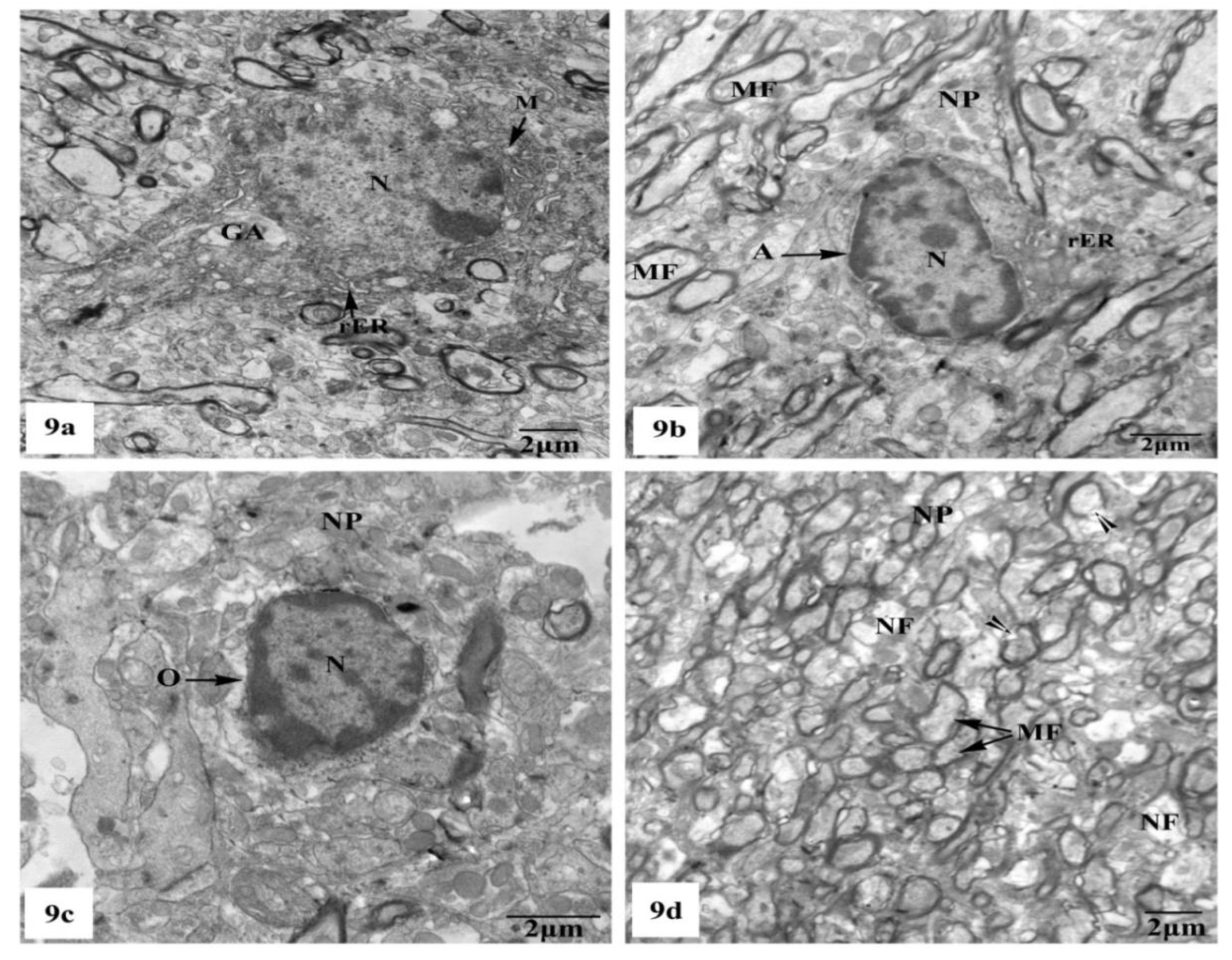 Brainsci 10 00628 g009