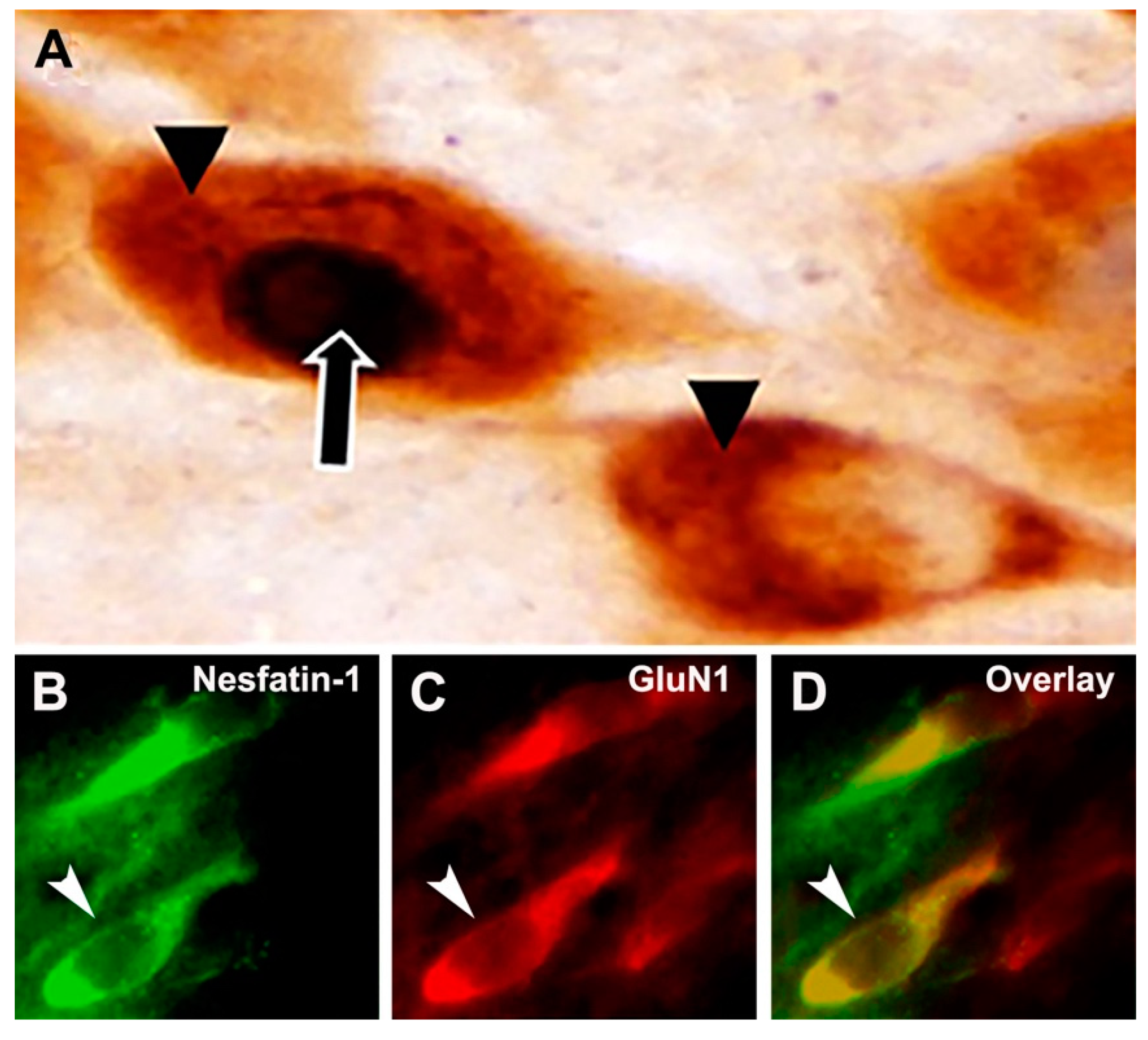 Brainsci 10 00630 g001 Brainsci 10 00630 g001