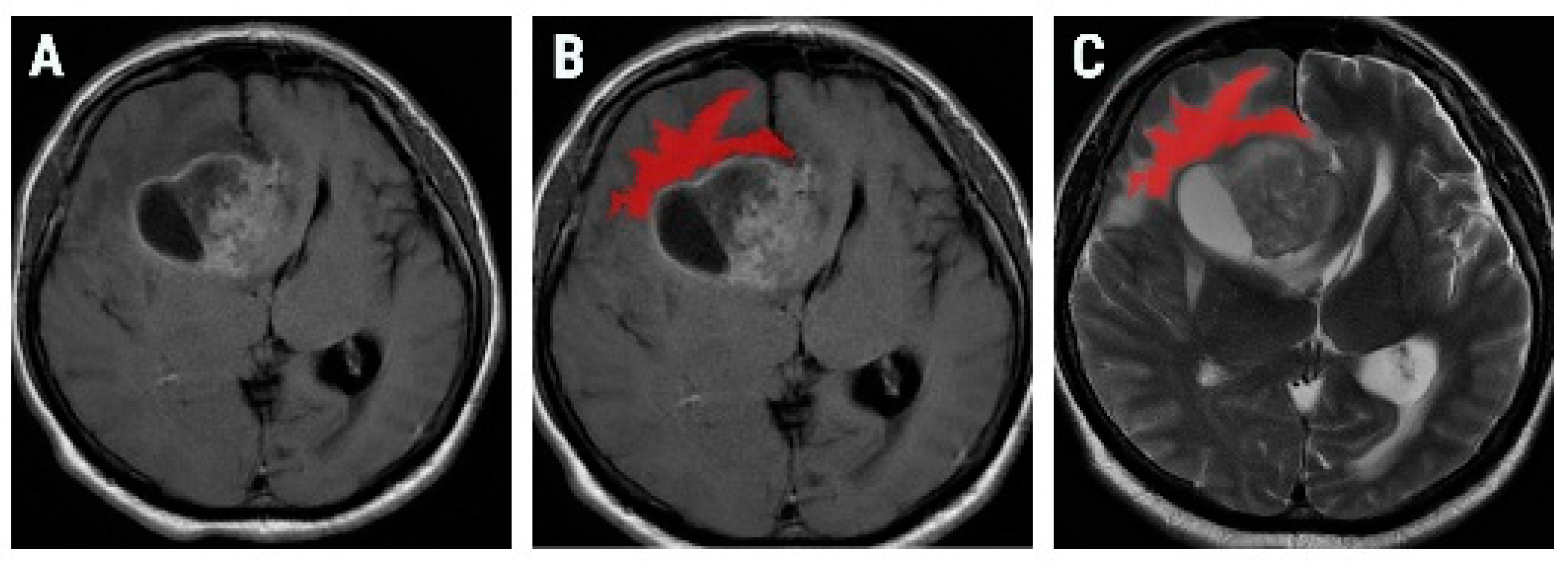 Brainsci 10 00638 g002 Brainsci 10 00638 g002