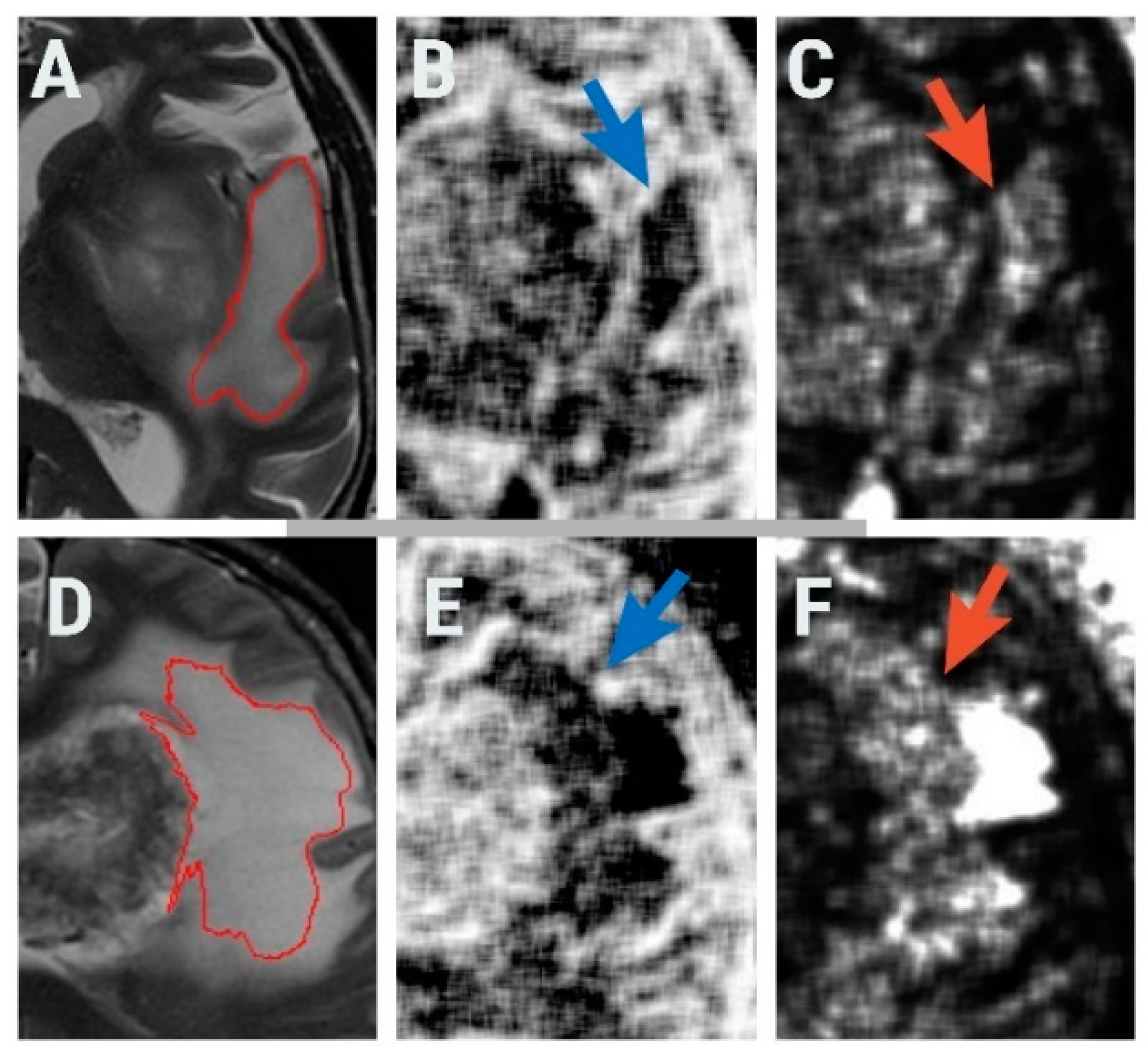 Brainsci 10 00638 g004 Brainsci 10 00638 g004