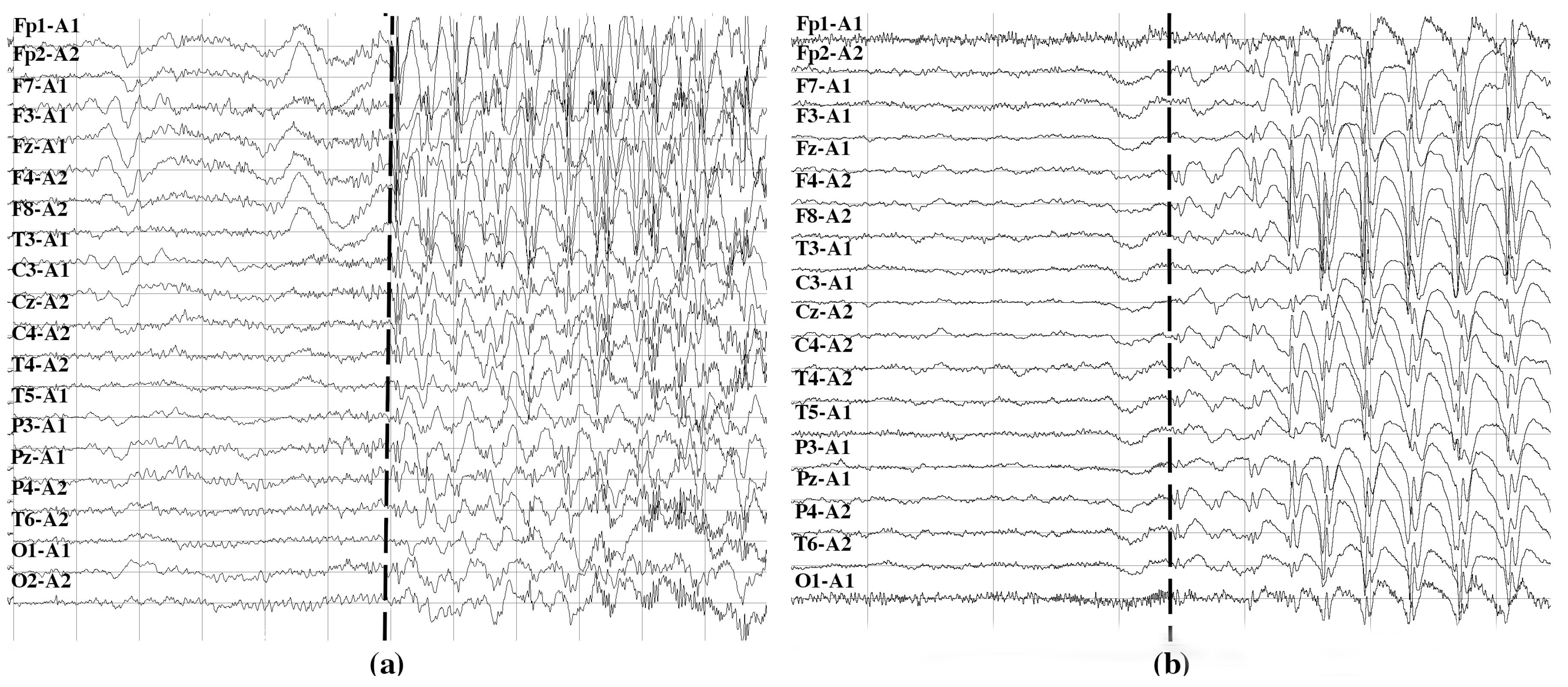 Brainsci 10 00657 g003