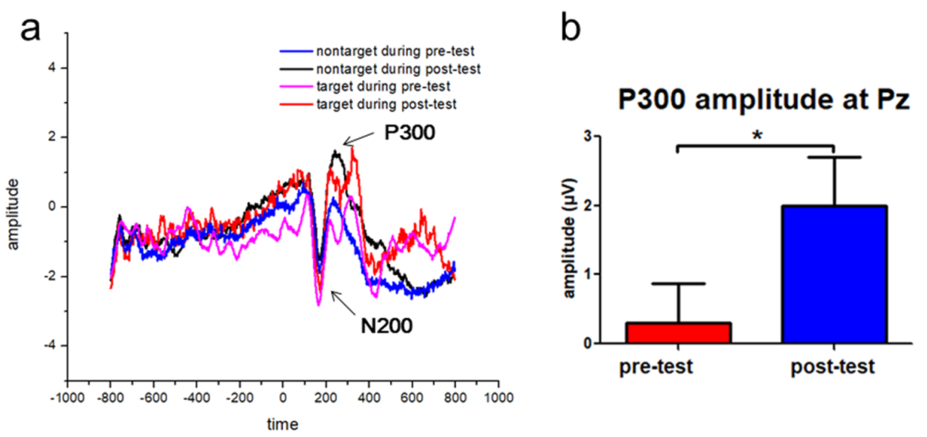 Brainsci 10 00695 g004