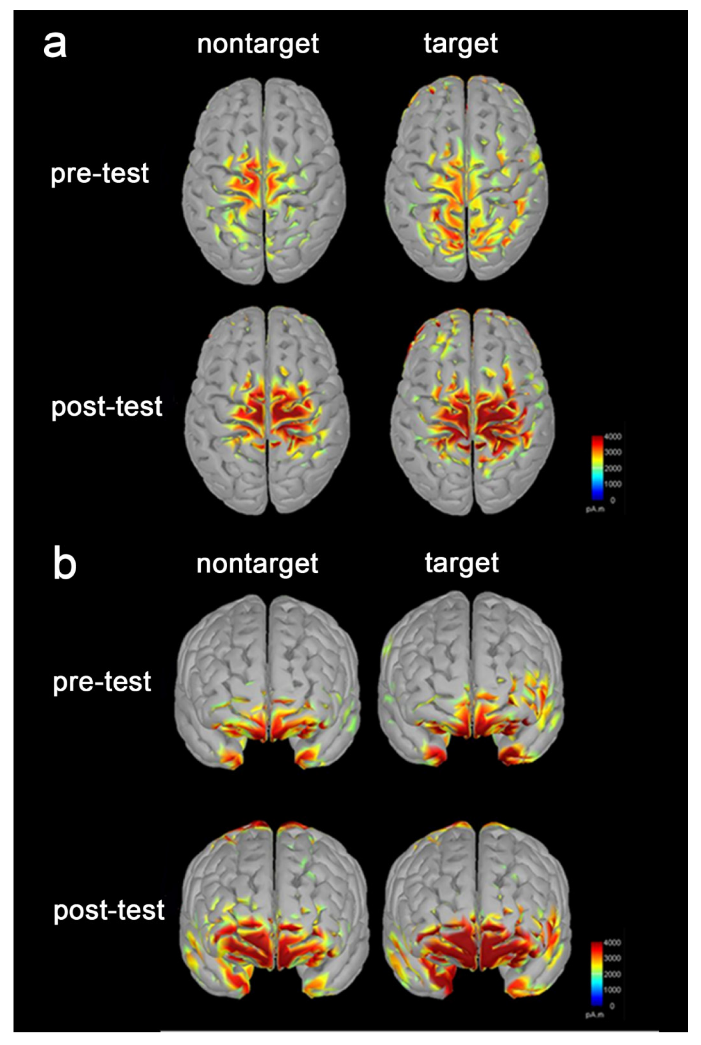 Brainsci 10 00695 g005