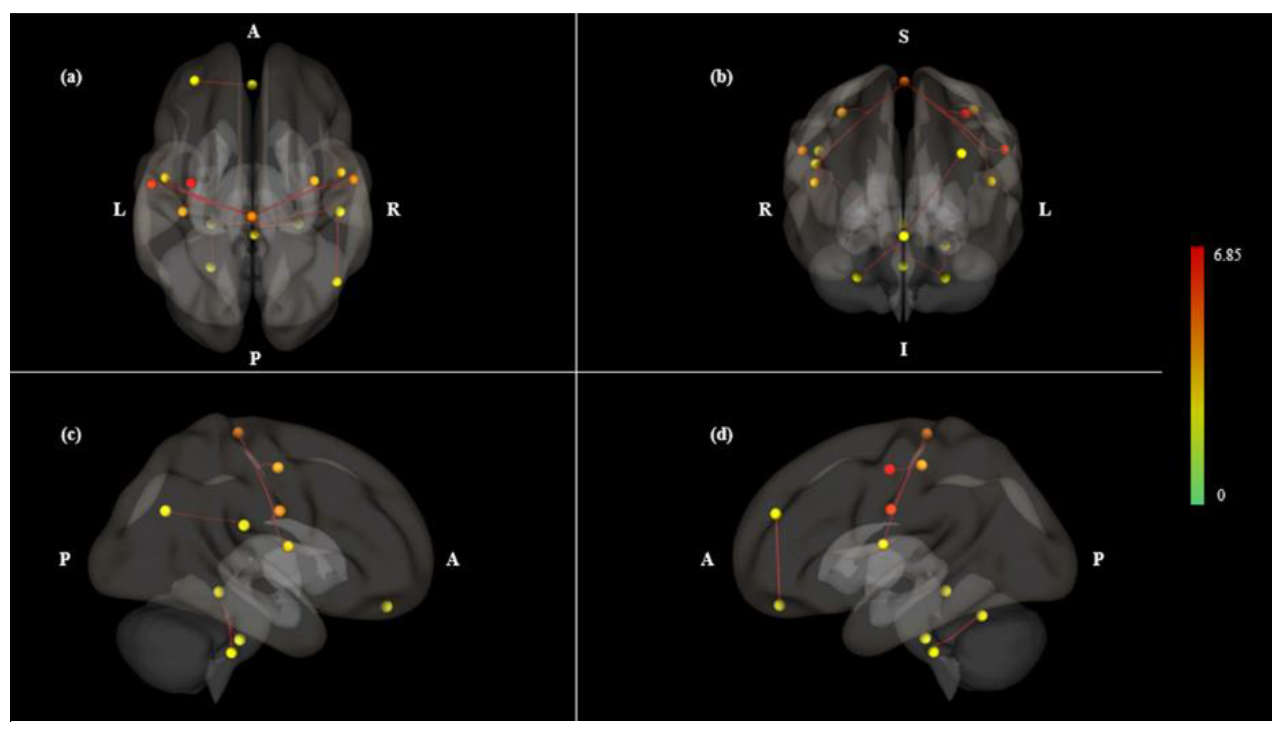 Brainsci 10 00704 g003 Brainsci 10 00704 g003