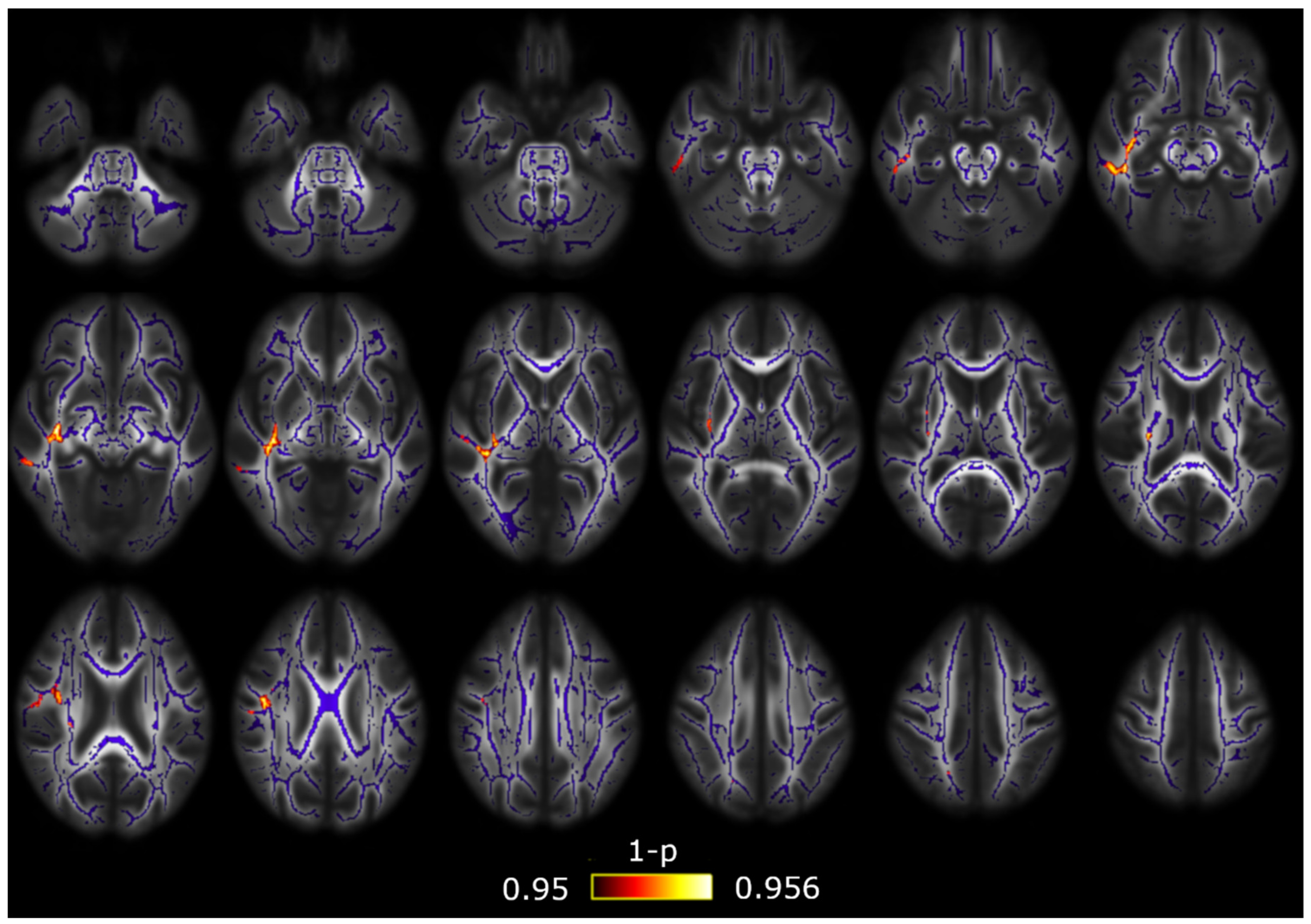 Brainsci 10 00711 g0a2 Brainsci 10 00711 g0a2