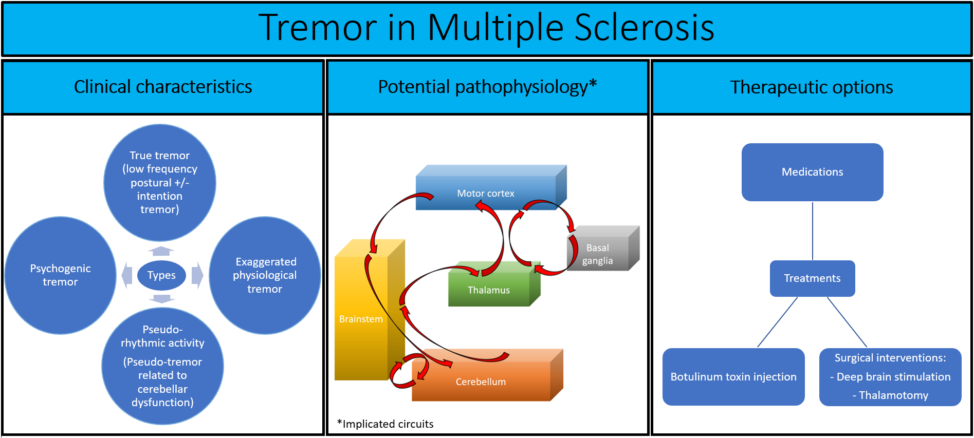 Brain Sciences Free Full Text Tremor In Multiple Sclerosis An