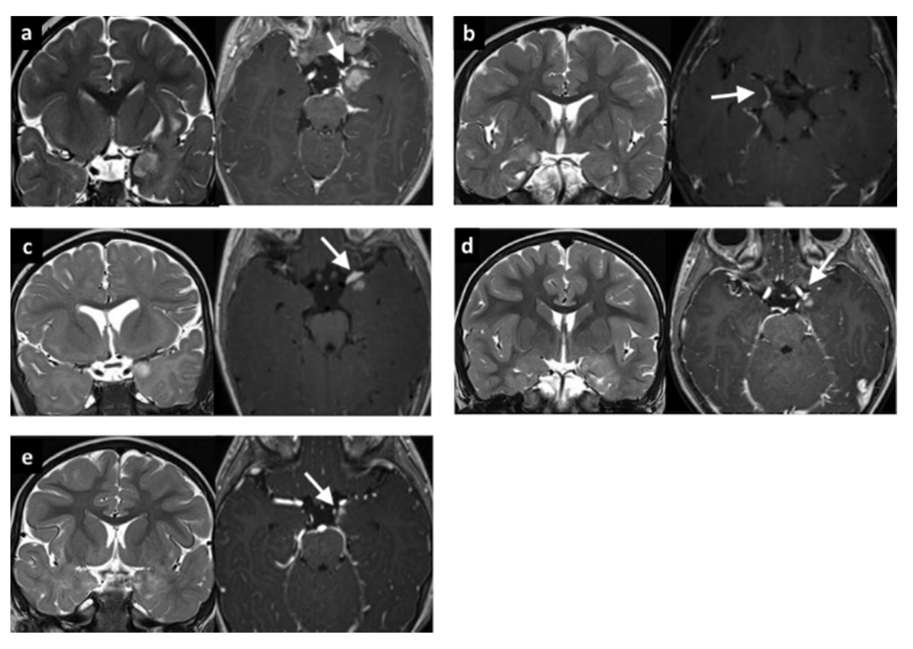Brainsci 10 00752 g002