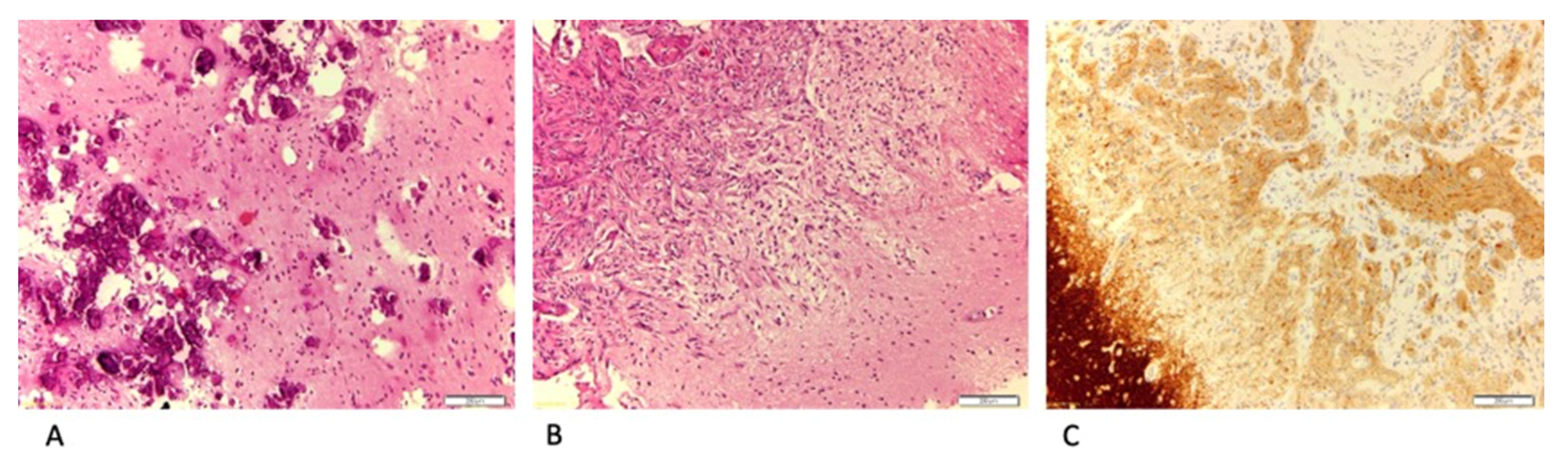 Brainsci 10 00752 g003