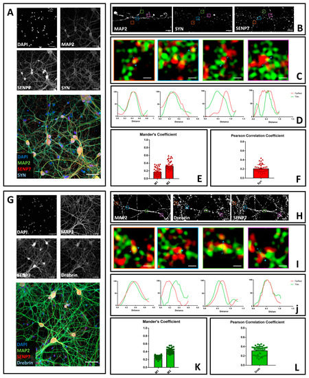 Brain Sciences Free Full Text Neuronal Localization Of Senp Proteins With Super Resolution Microscopy Html Brain Sciences Free Full Text Neuronal Localization Of Senp Proteins With Super Resolution Microscopy Html