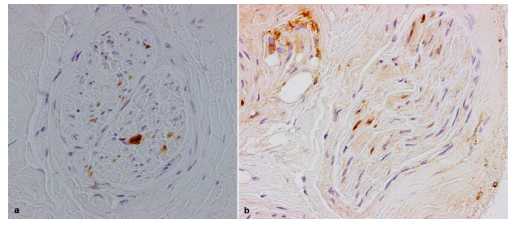 Brainsci 10 00780 g004 Brainsci 10 00780 g004