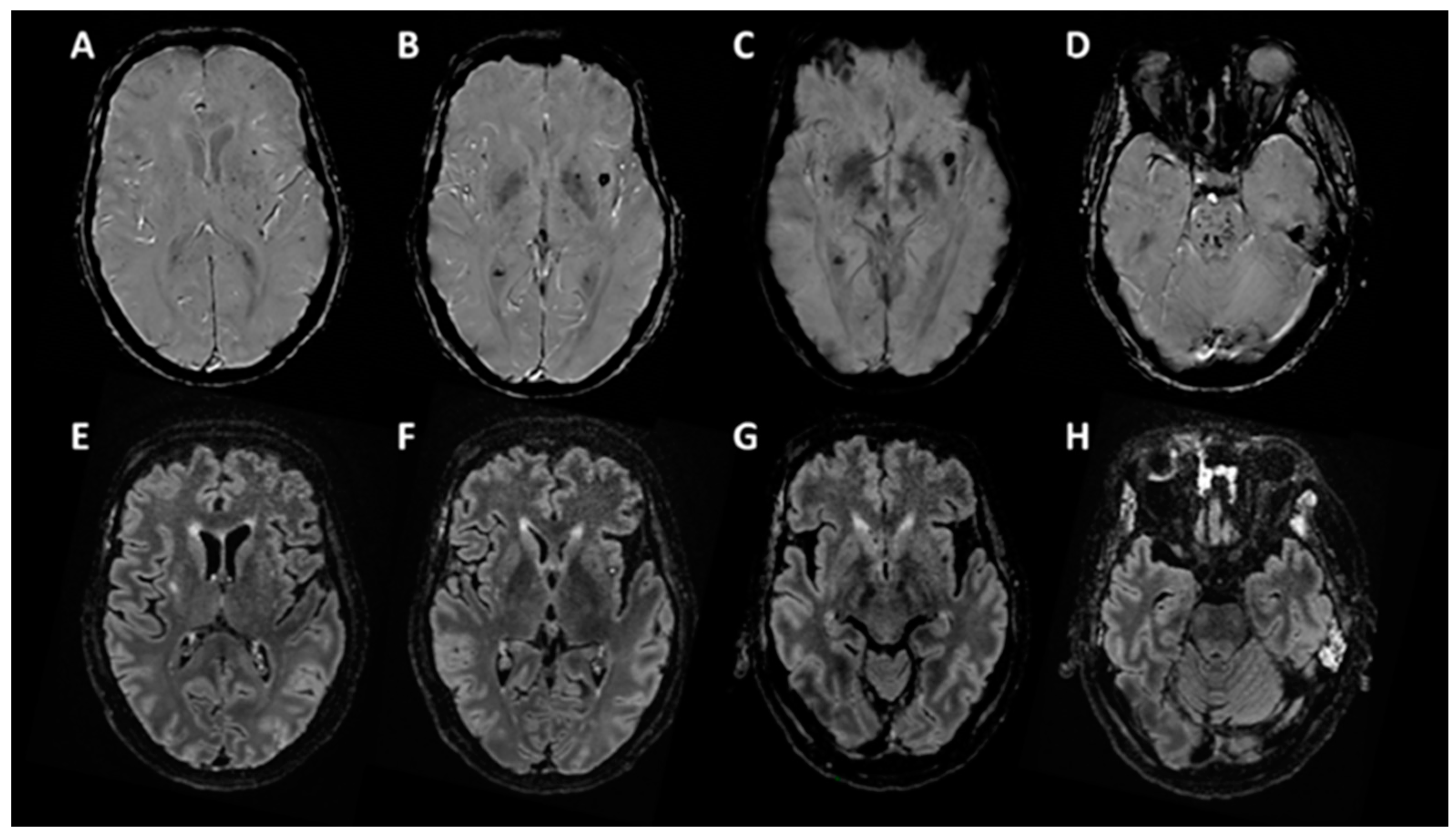 Brainsci 10 00845 g001