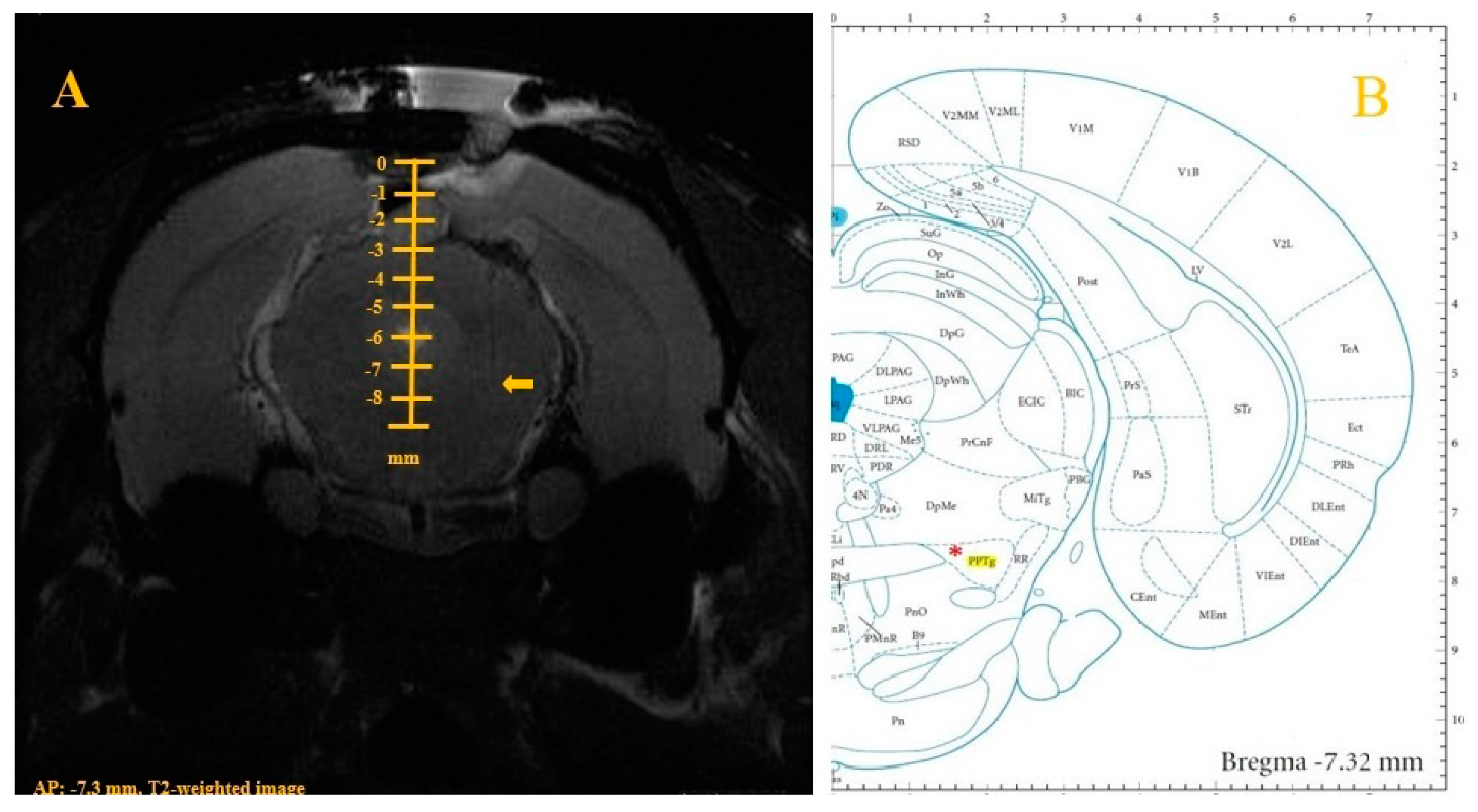 Brainsci 10 00850 g004