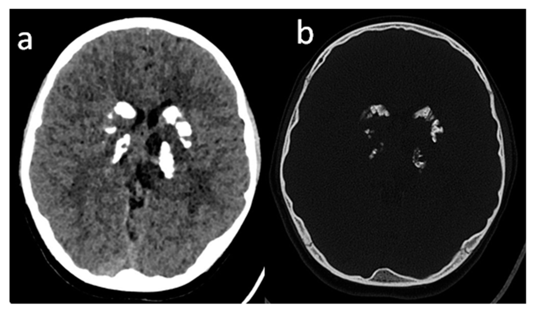 Brainsci 10 00869 g001