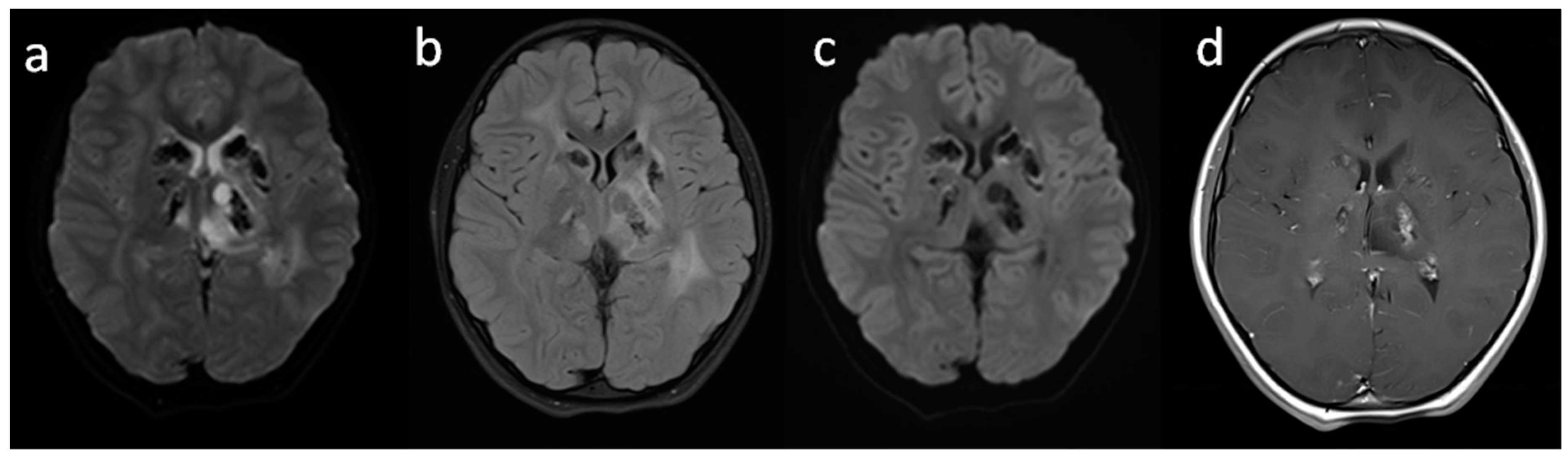 Brainsci 10 00869 g002