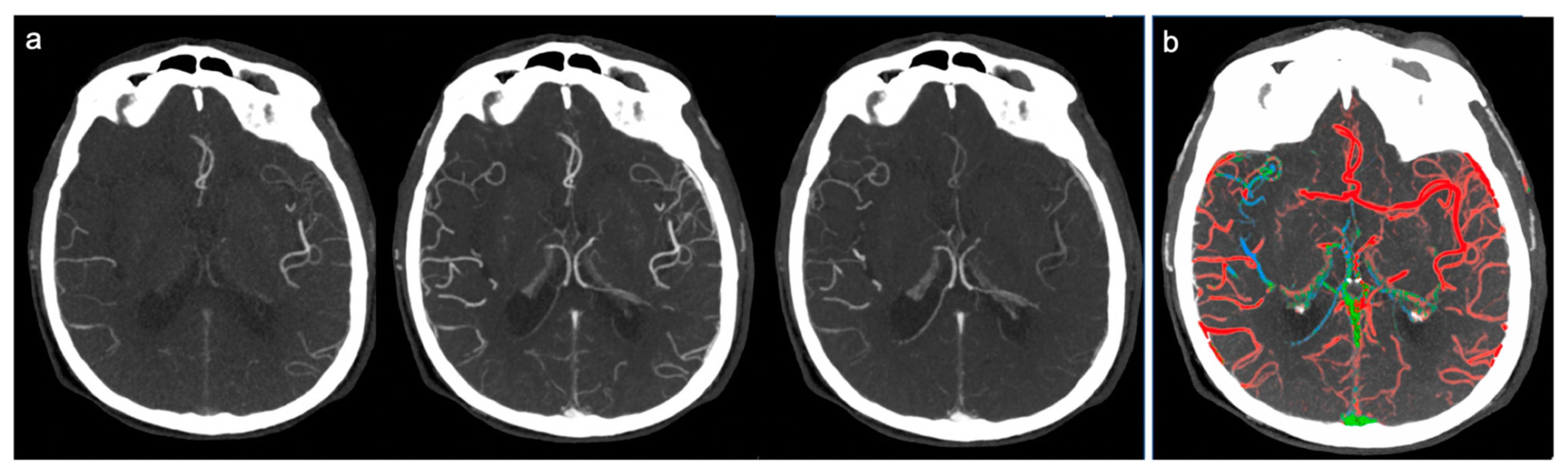 Brainsci 10 00882 g001