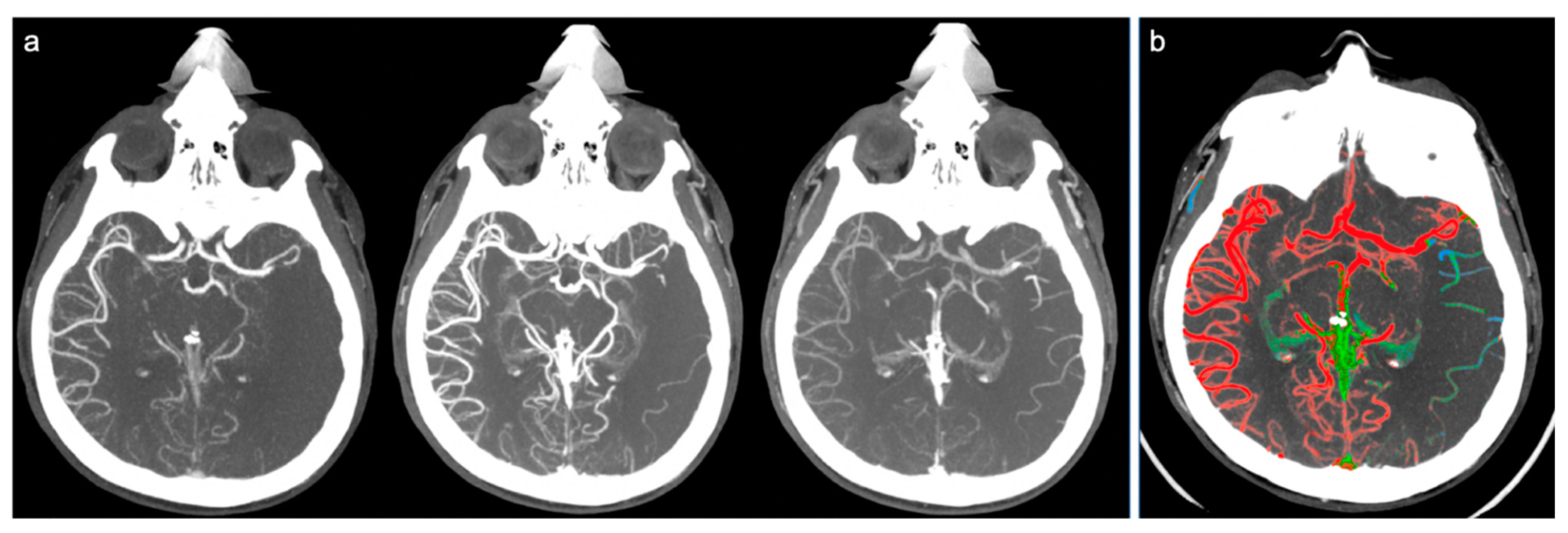 Brainsci 10 00882 g003
