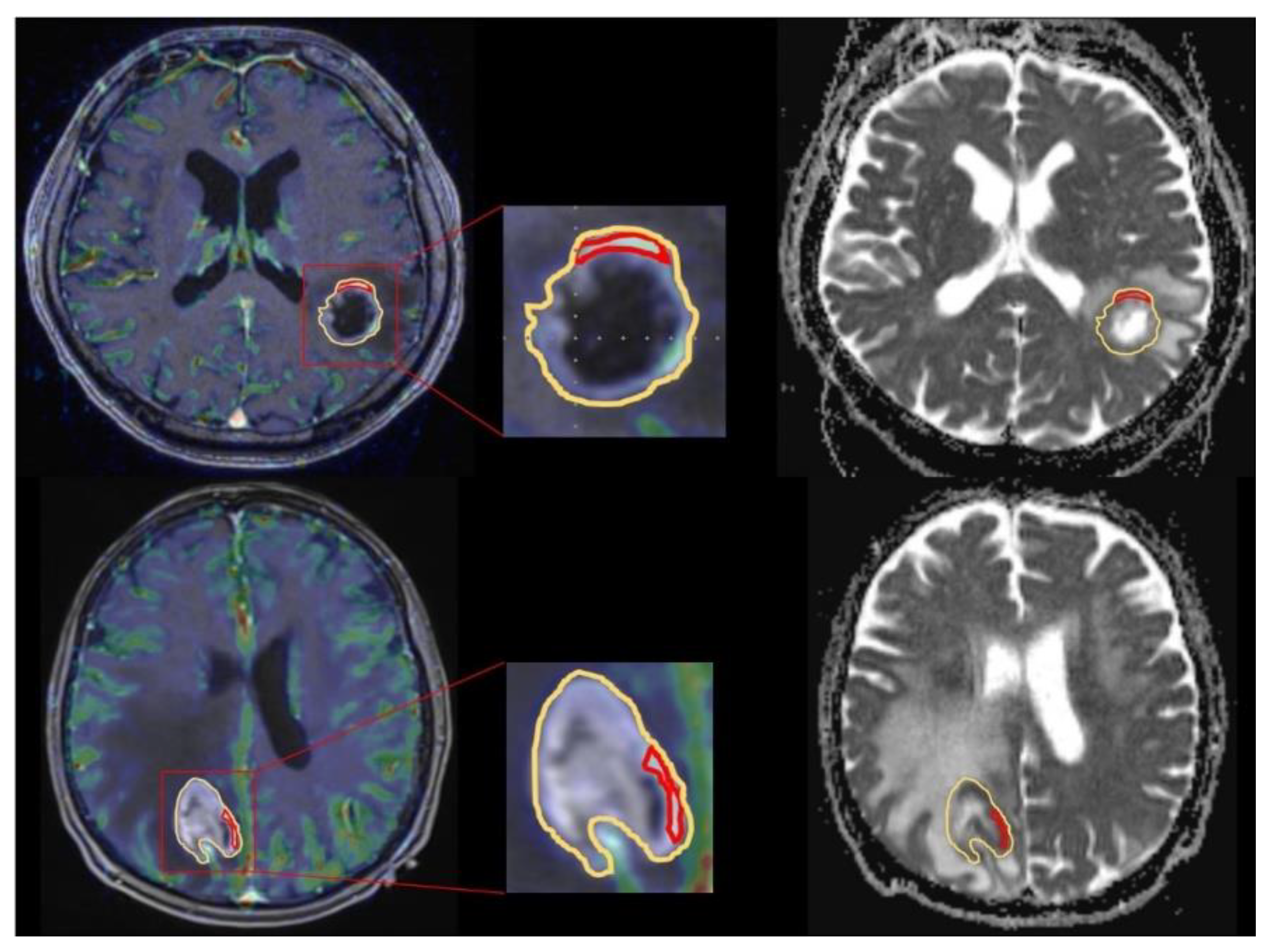 Brainsci 10 00886 g001 Brainsci 10 00886 g001