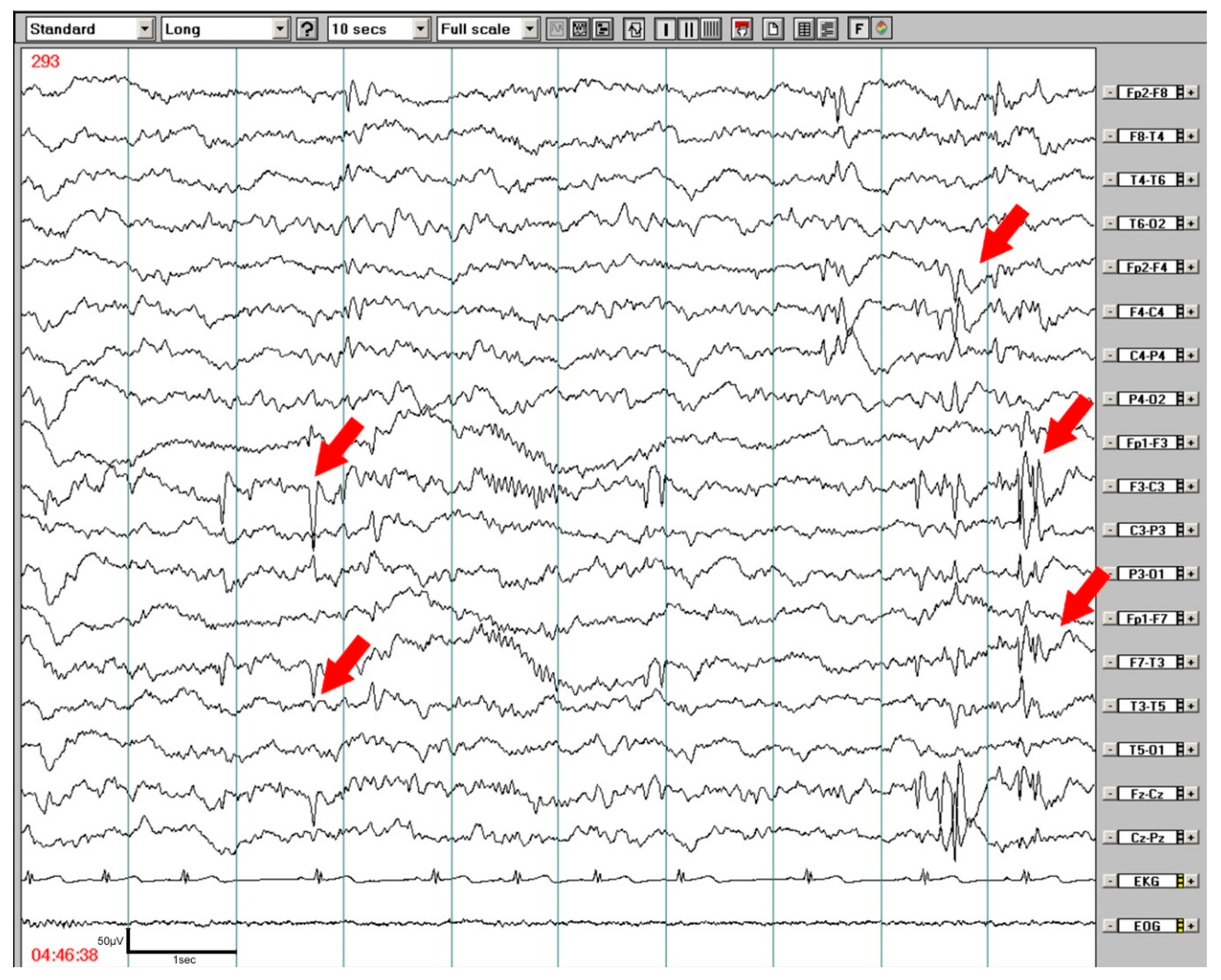 Brainsci 10 00910 g002 Brainsci 10 00910 g002