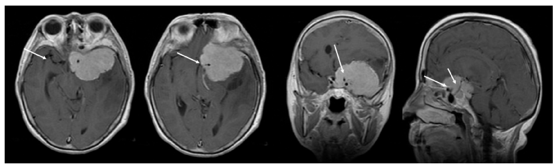 Brainsci 10 00957 g002 Brainsci 10 00957 g002