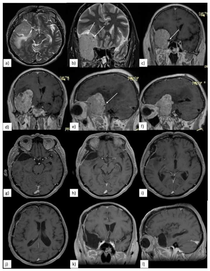 Brainsci 10 00957 g003 Brainsci 10 00957 g003