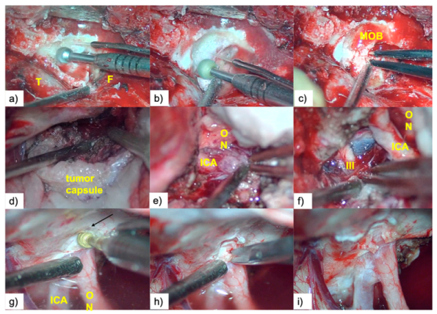 Brainsci 10 00957 g004 Brainsci 10 00957 g004