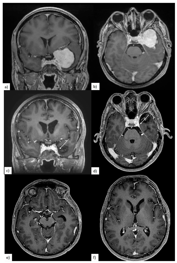 Brainsci 10 00957 g006 Brainsci 10 00957 g006
