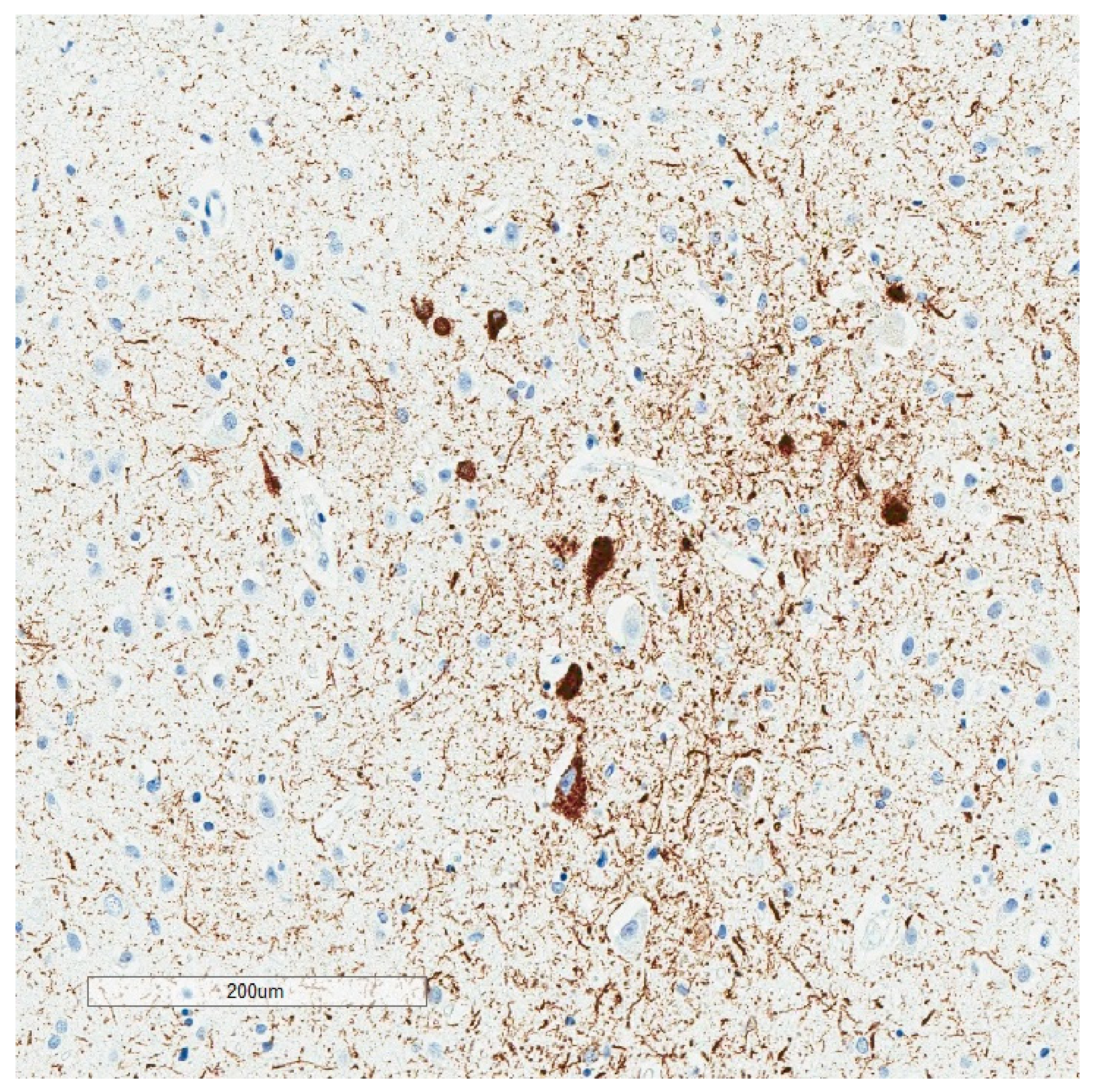 Brainsci 10 00972 g005 Brainsci 10 00972 g005