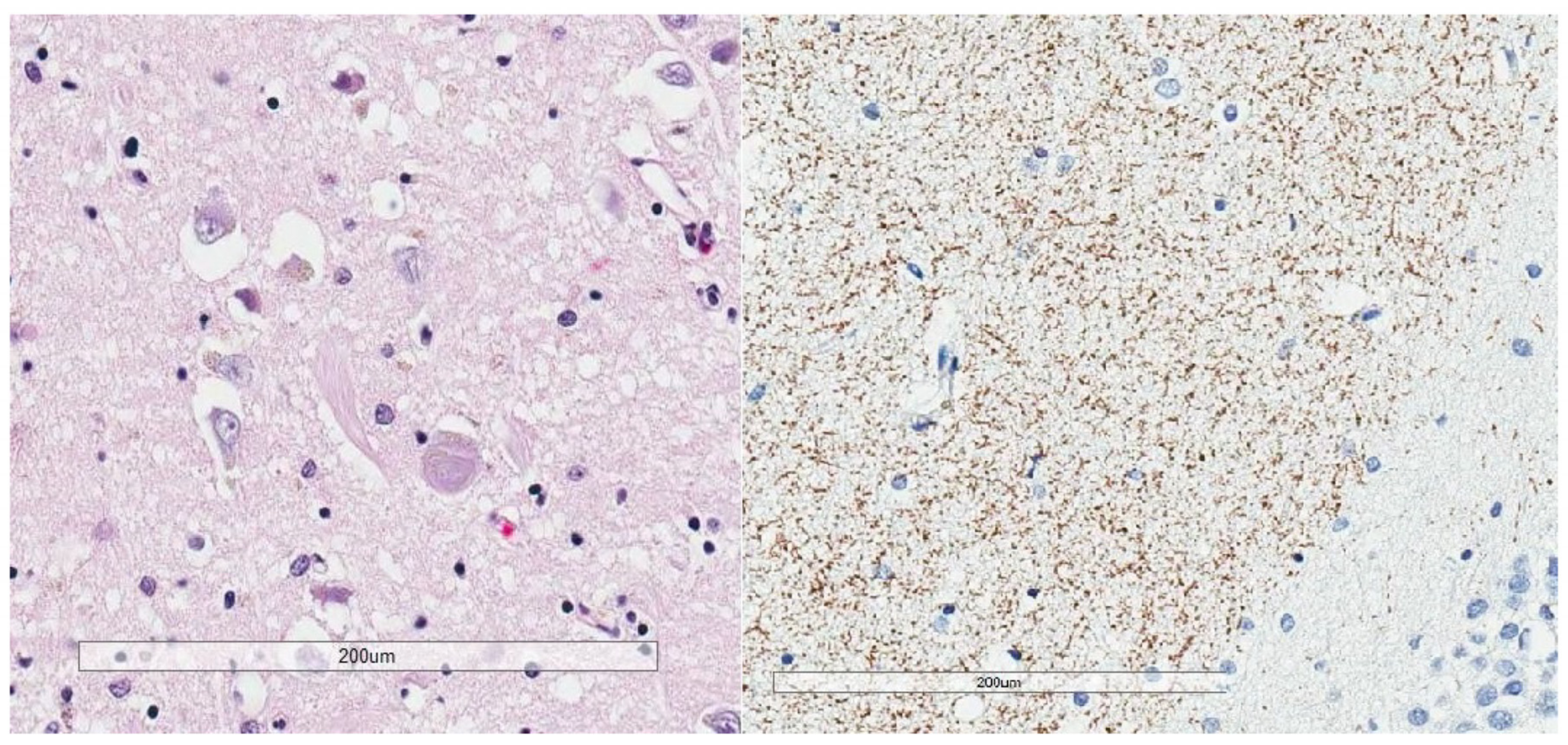 Brainsci 10 00972 g006 Brainsci 10 00972 g006