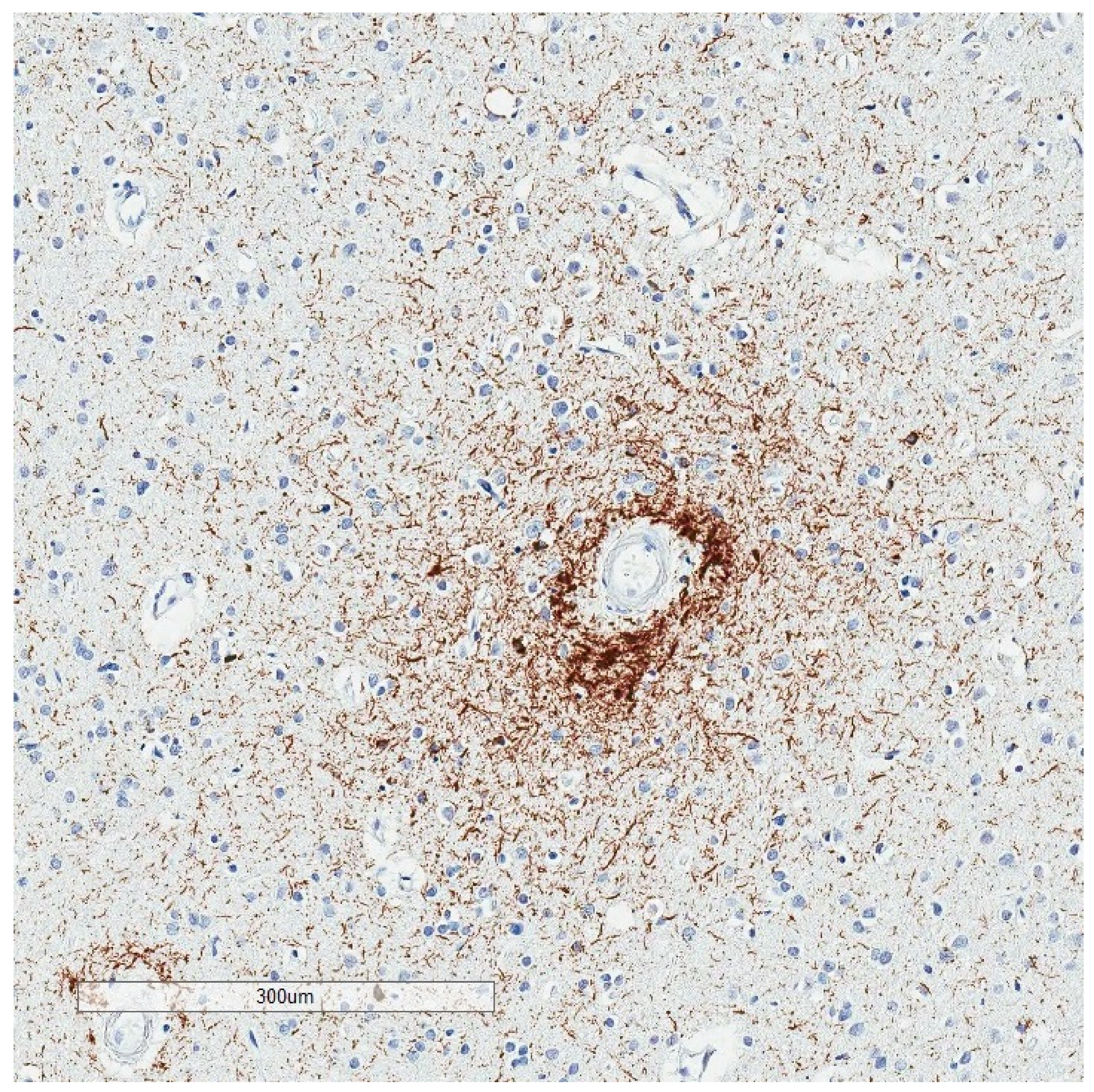 Brainsci 10 00972 g008 Brainsci 10 00972 g008