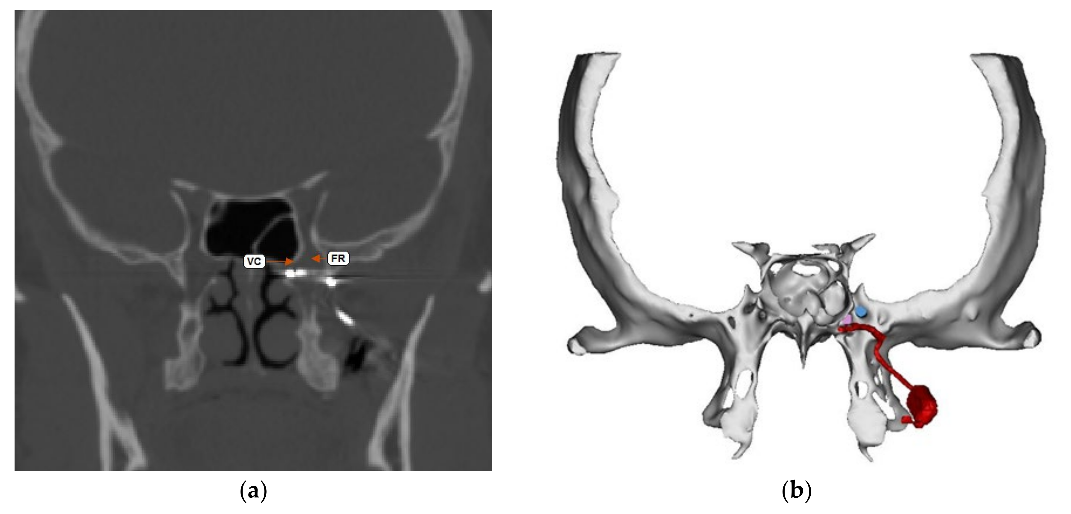 Brainsci 10 00973 g001