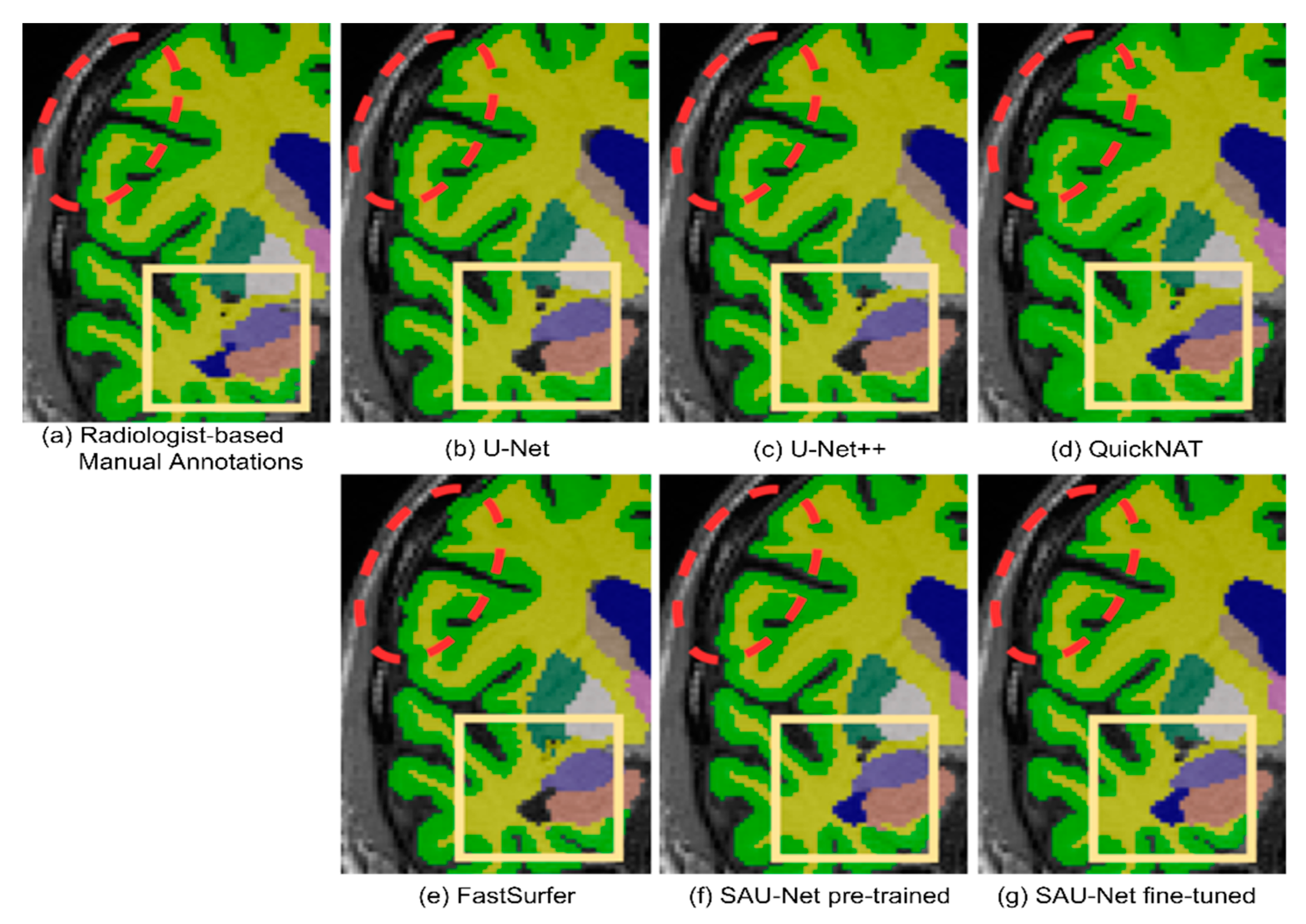 Brainsci 10 00974 g007 Brainsci 10 00974 g007