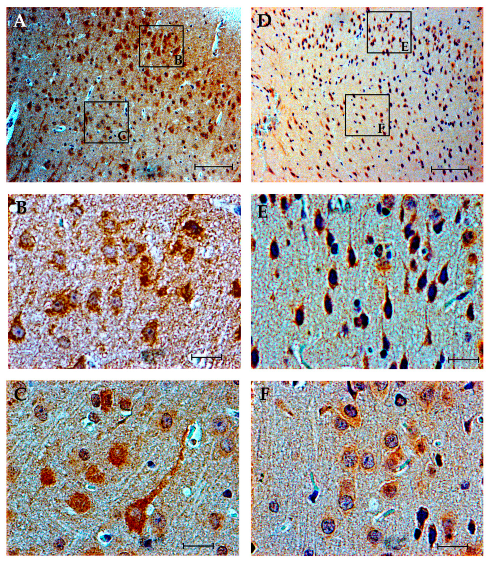 Brainsci 10 00987 g004 Brainsci 10 00987 g004