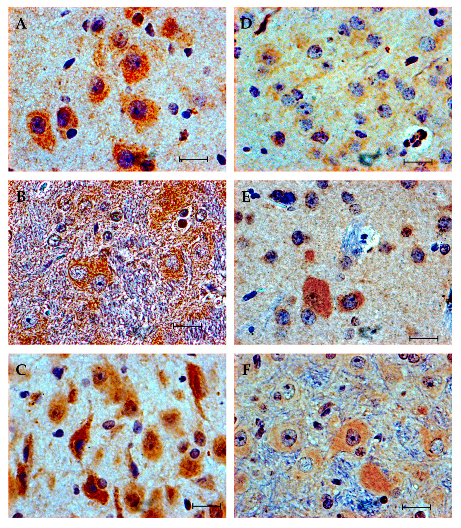 Brainsci 10 00987 g005 Brainsci 10 00987 g005