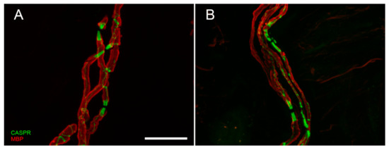 Brainsci 10 00989 g003 550